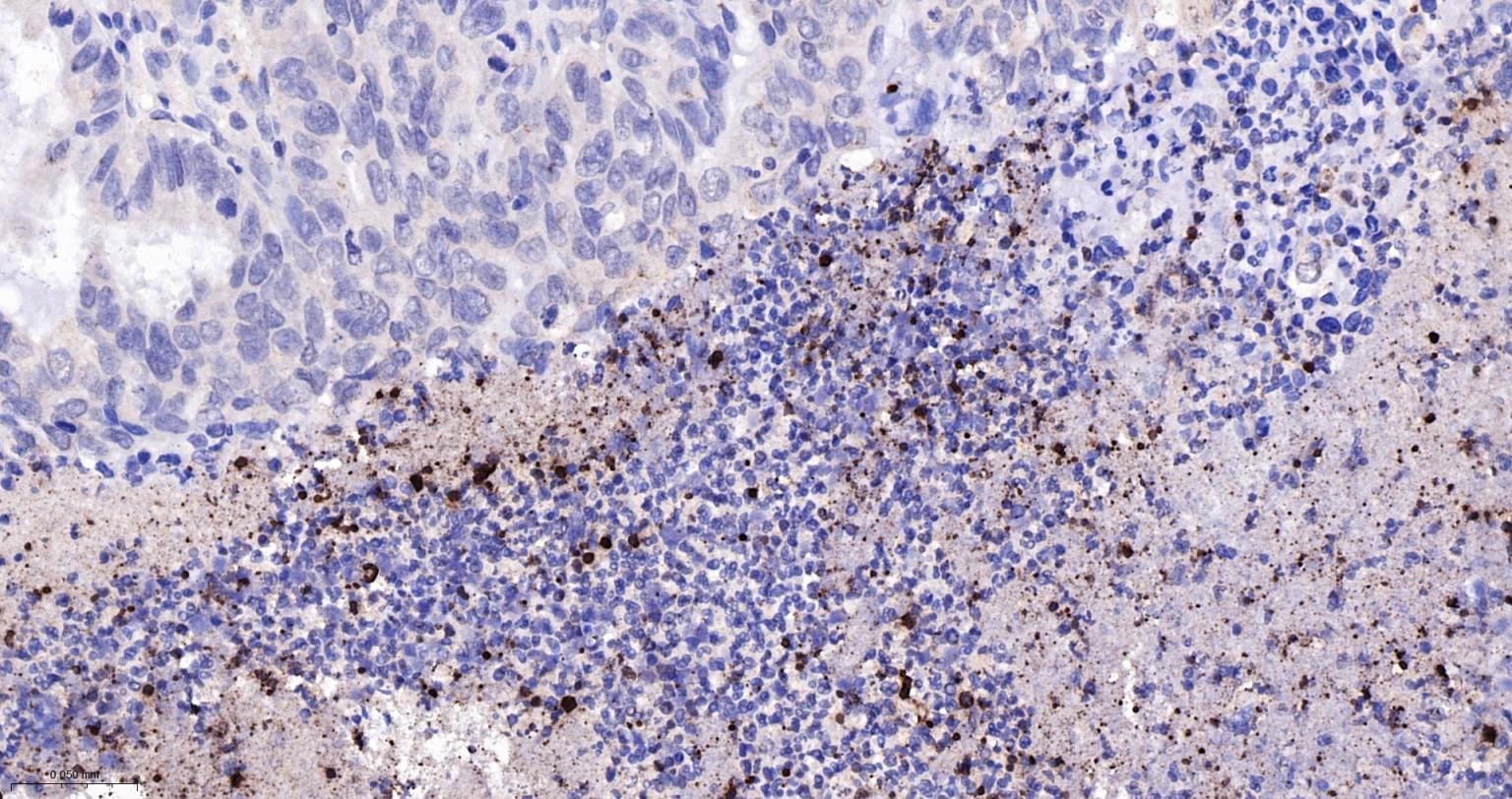 瓜氨酸组蛋白3重组兔单抗