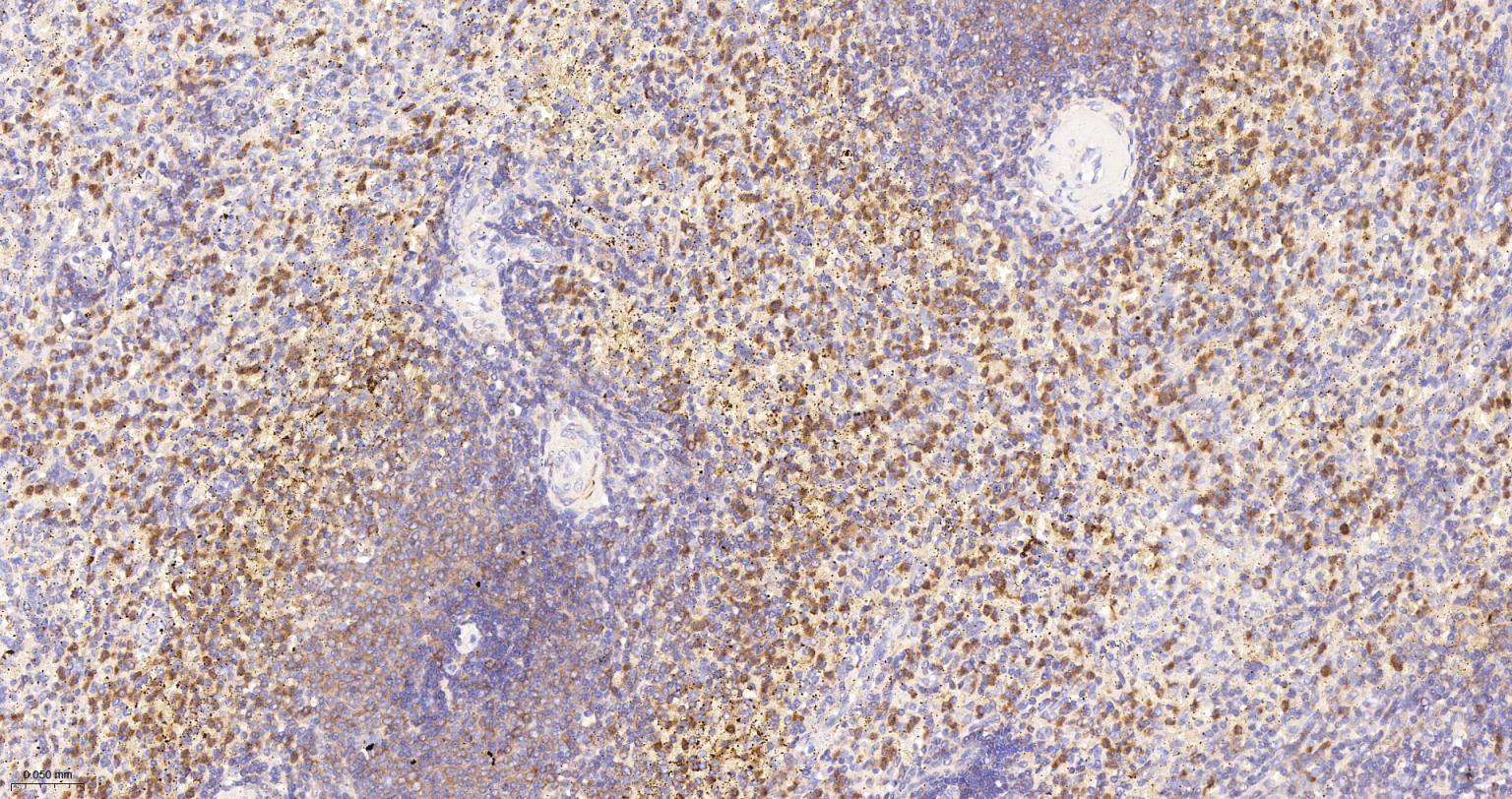 核因子κB抑制蛋白E重组兔单抗