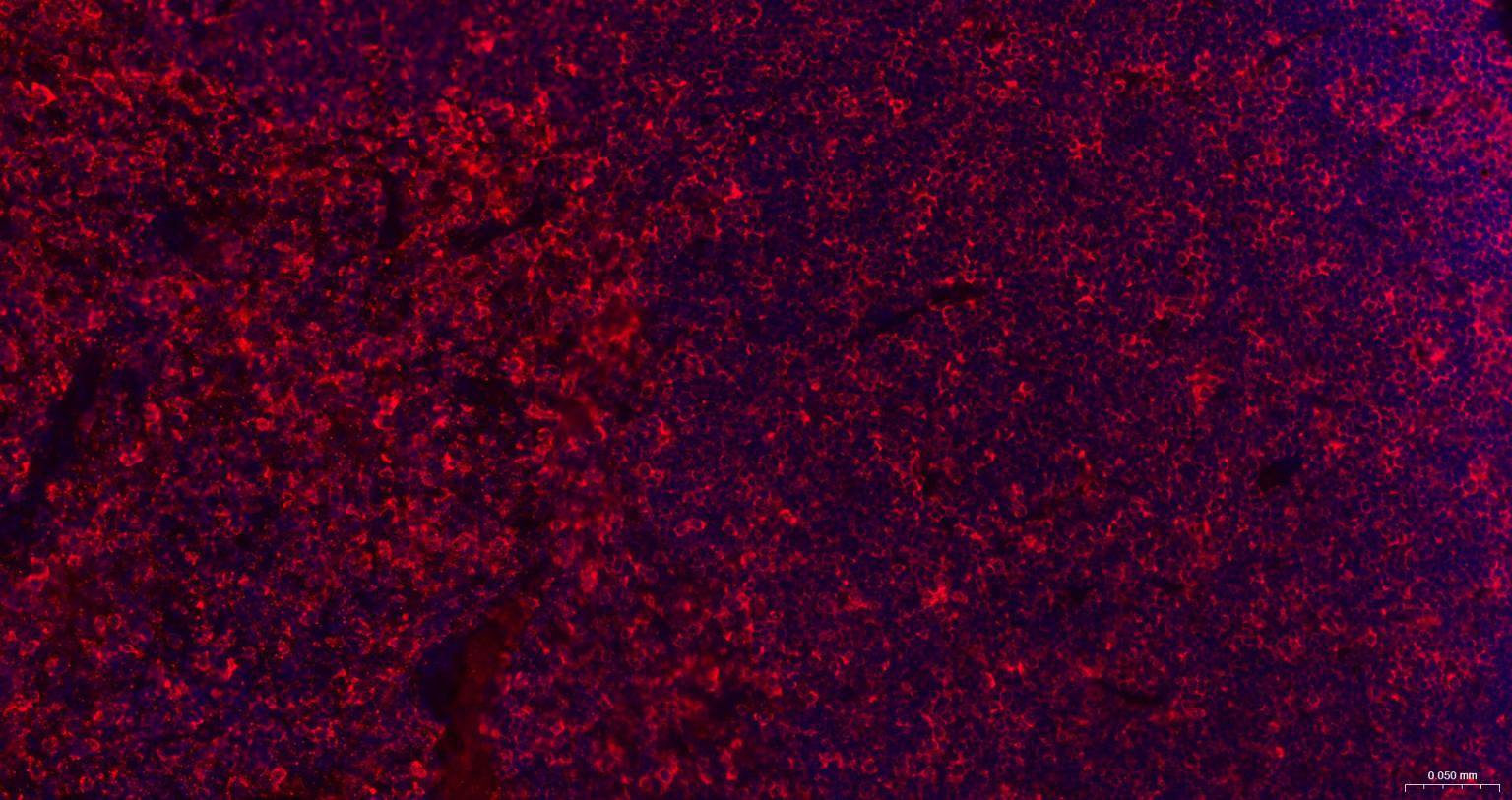 白血病相关蛋白18/癌蛋白18重组兔单抗