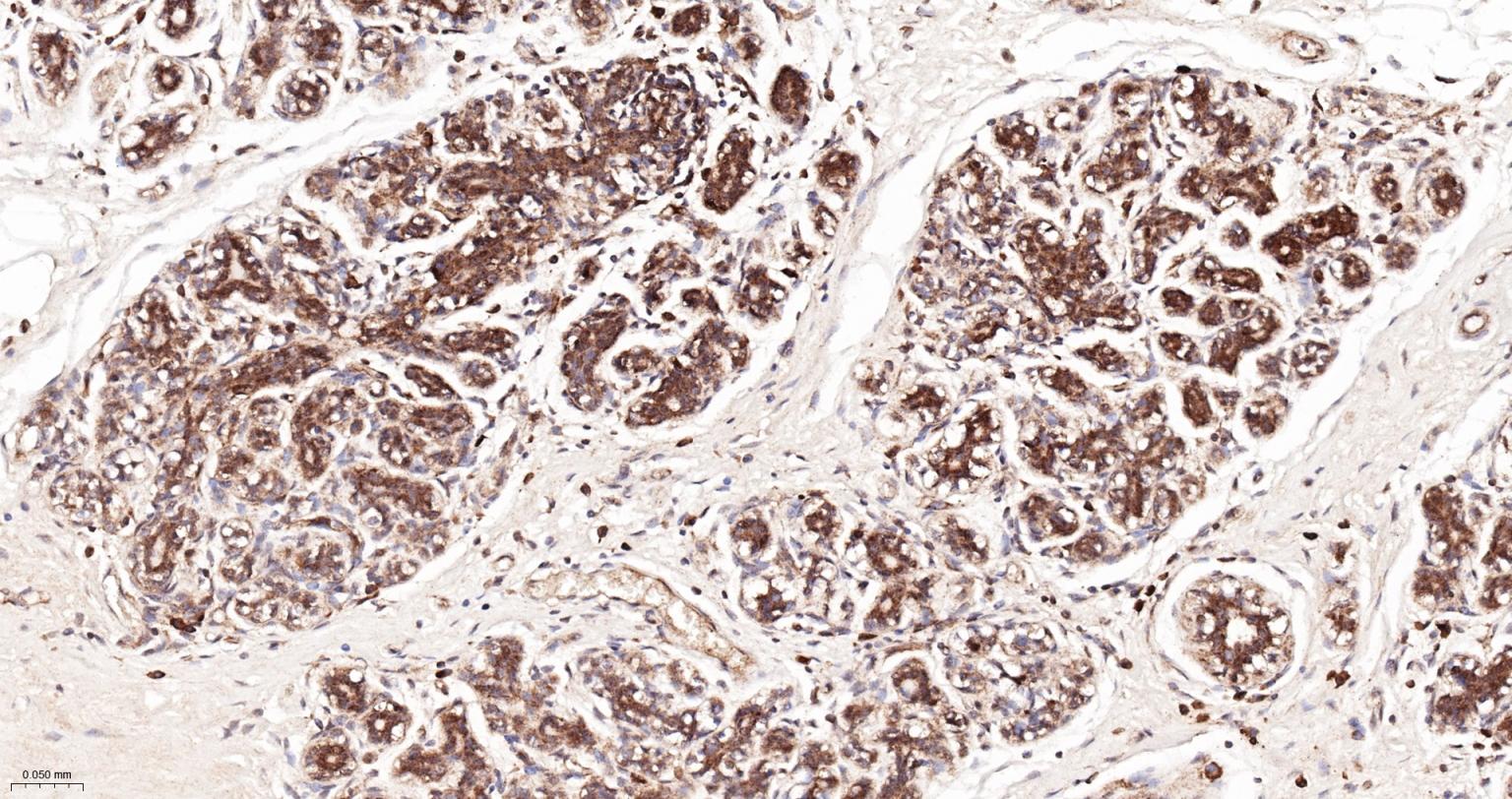 肌动蛋白相关蛋白2重组兔单抗