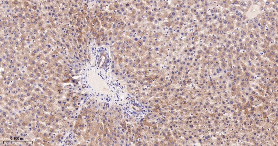 线粒体异柠檬酸脱氢酶重组兔单抗