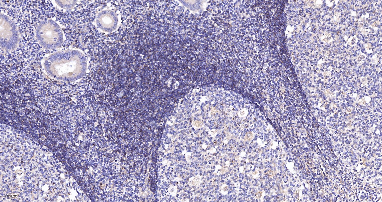 白介素1β/IL-1β抗体-bs-0812R