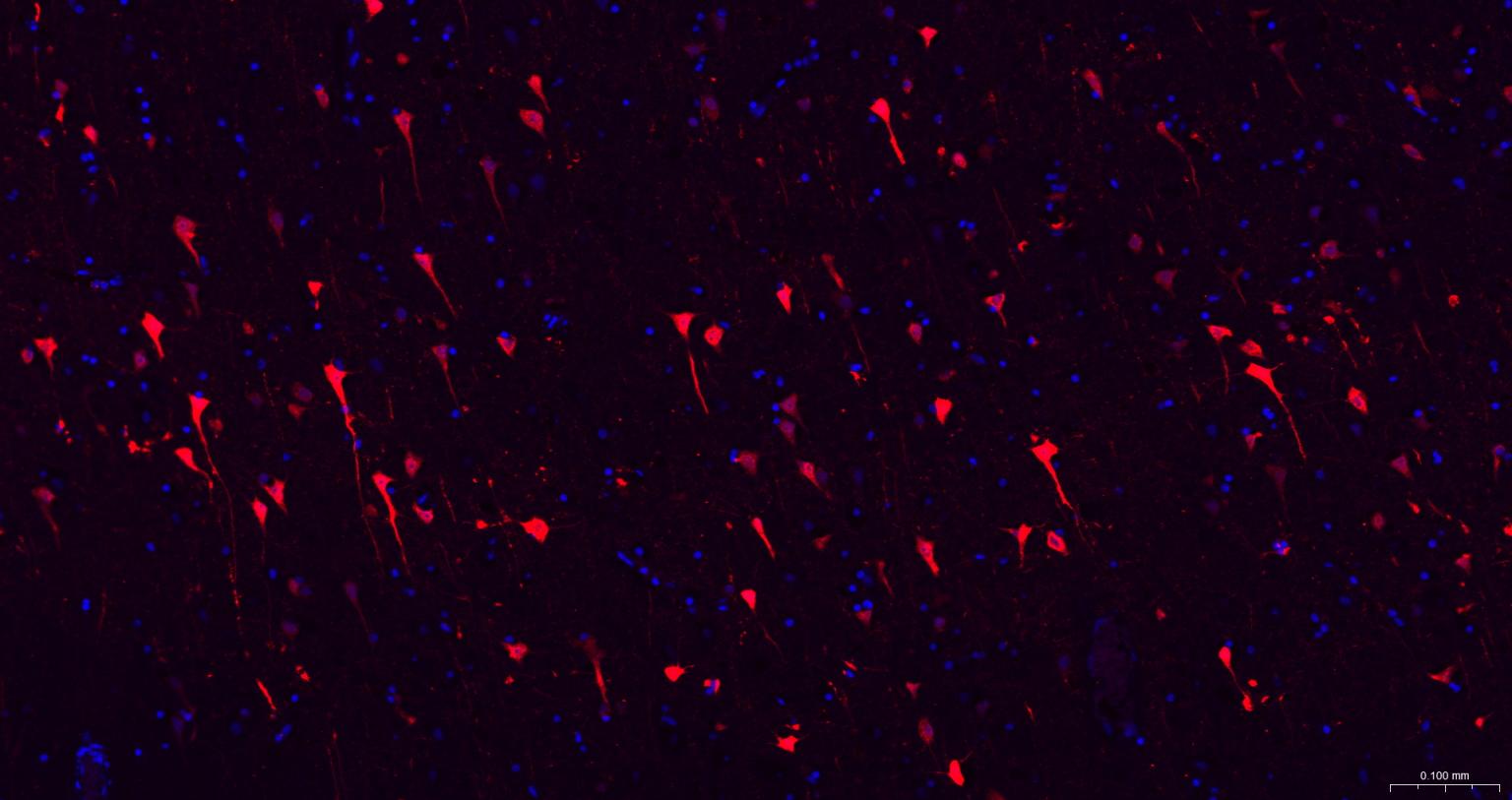 磷酸化微管相关蛋白2重组兔单抗-bsm-62863R