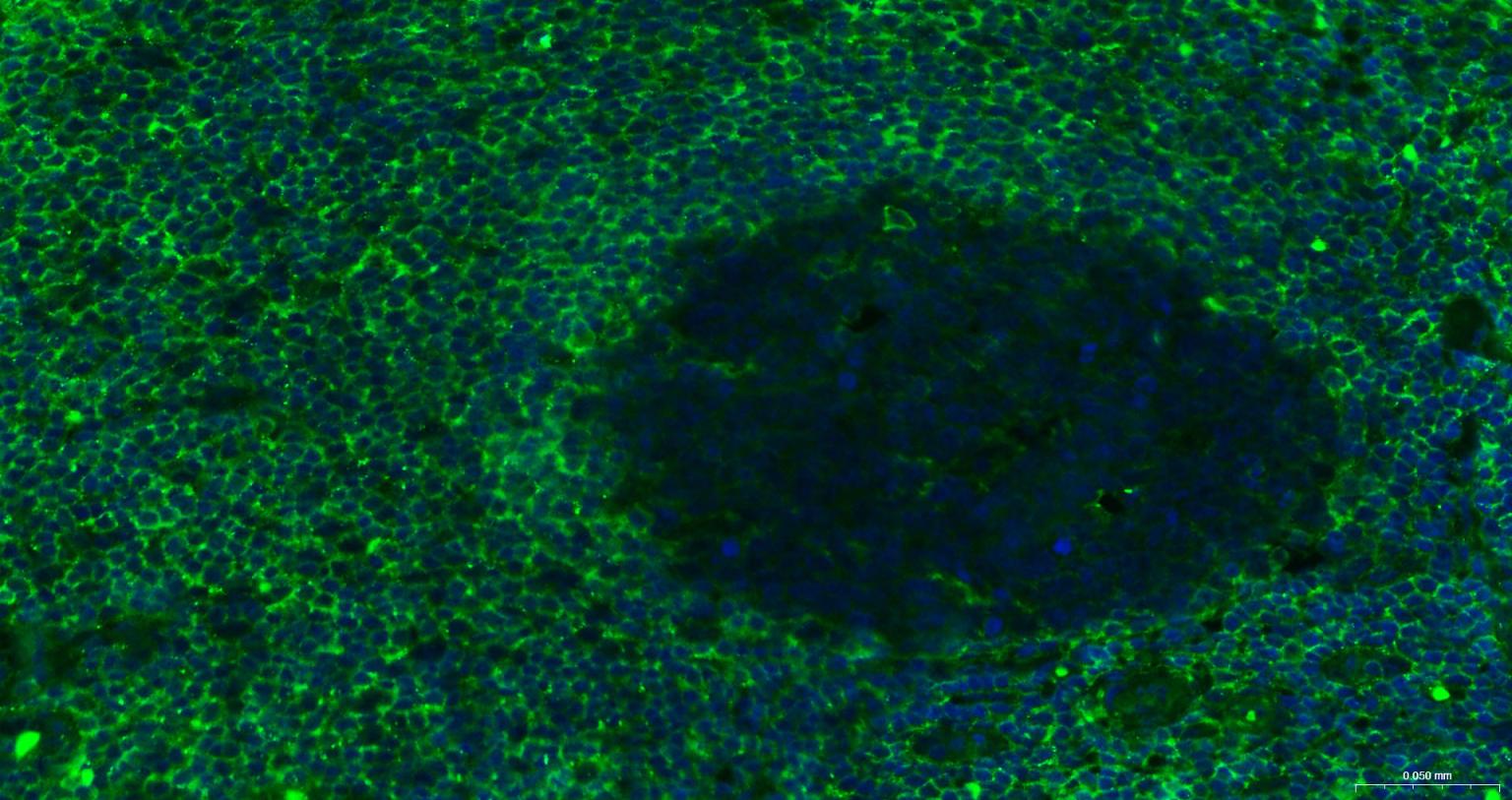 小鼠抗人CD44单克隆抗体-bsm-30038M