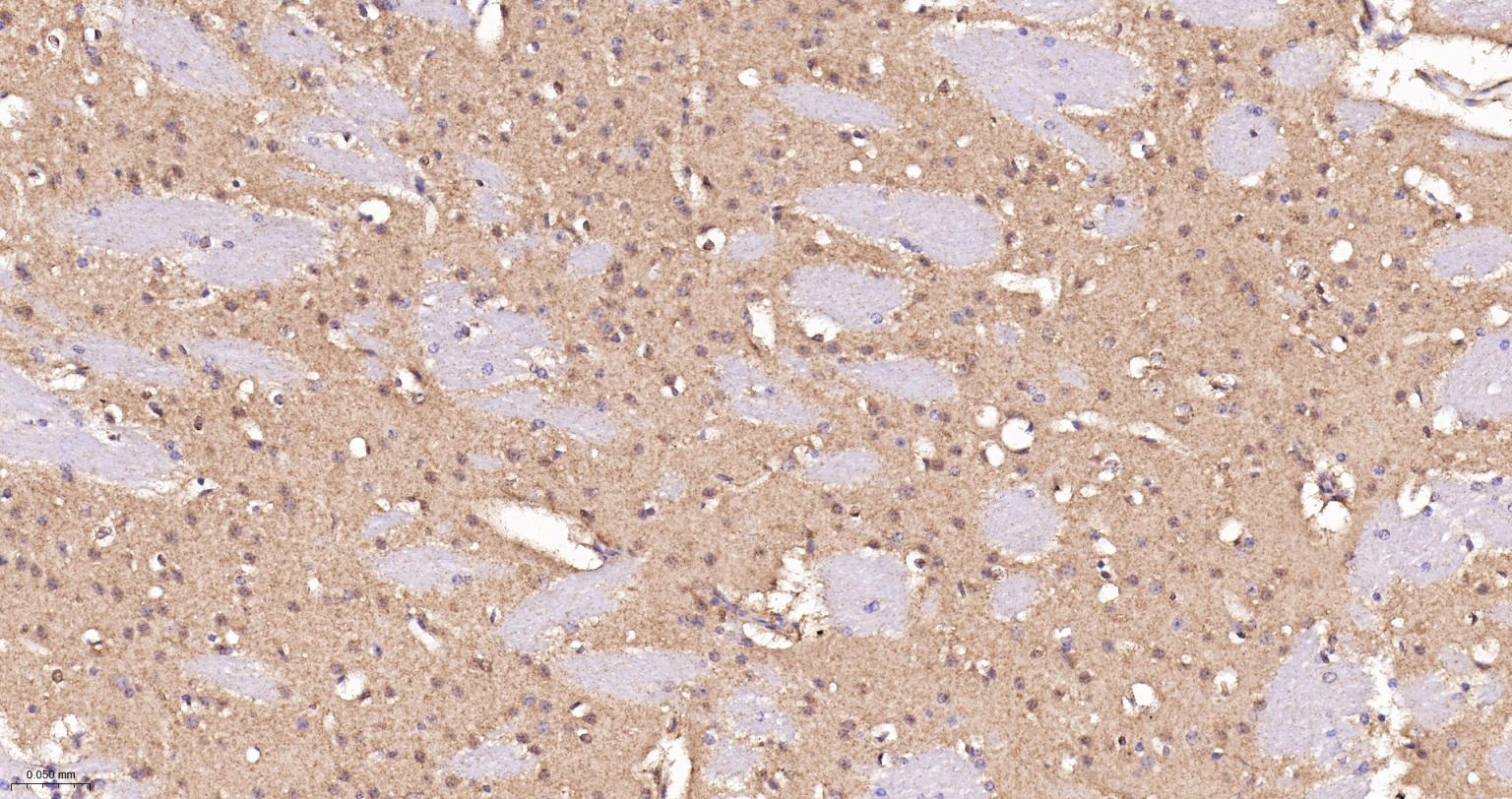 肌动蛋白相关蛋白2重组兔单抗