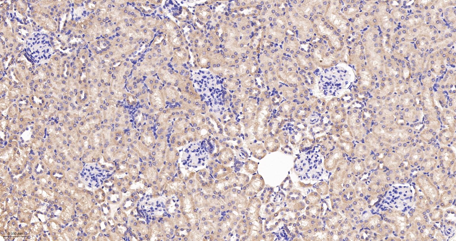 线粒体异柠檬酸脱氢酶重组兔单抗