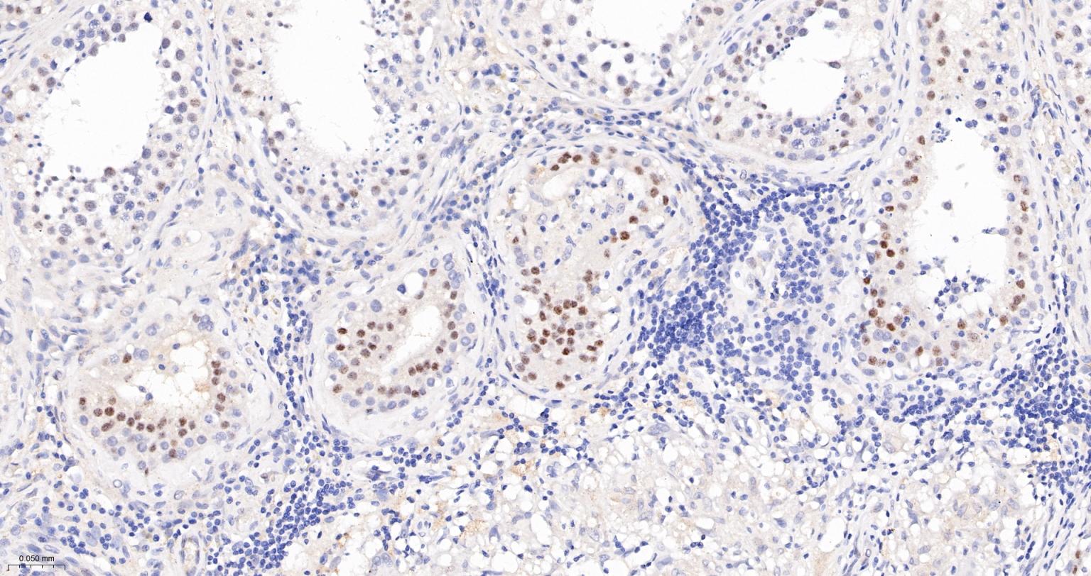 肾母细胞瘤蛋白重组兔单抗