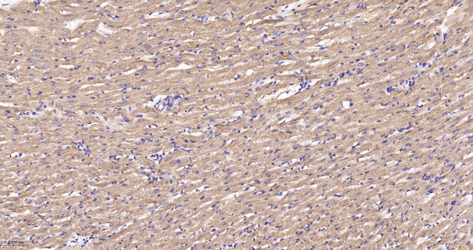 线粒体异柠檬酸脱氢酶重组兔单抗