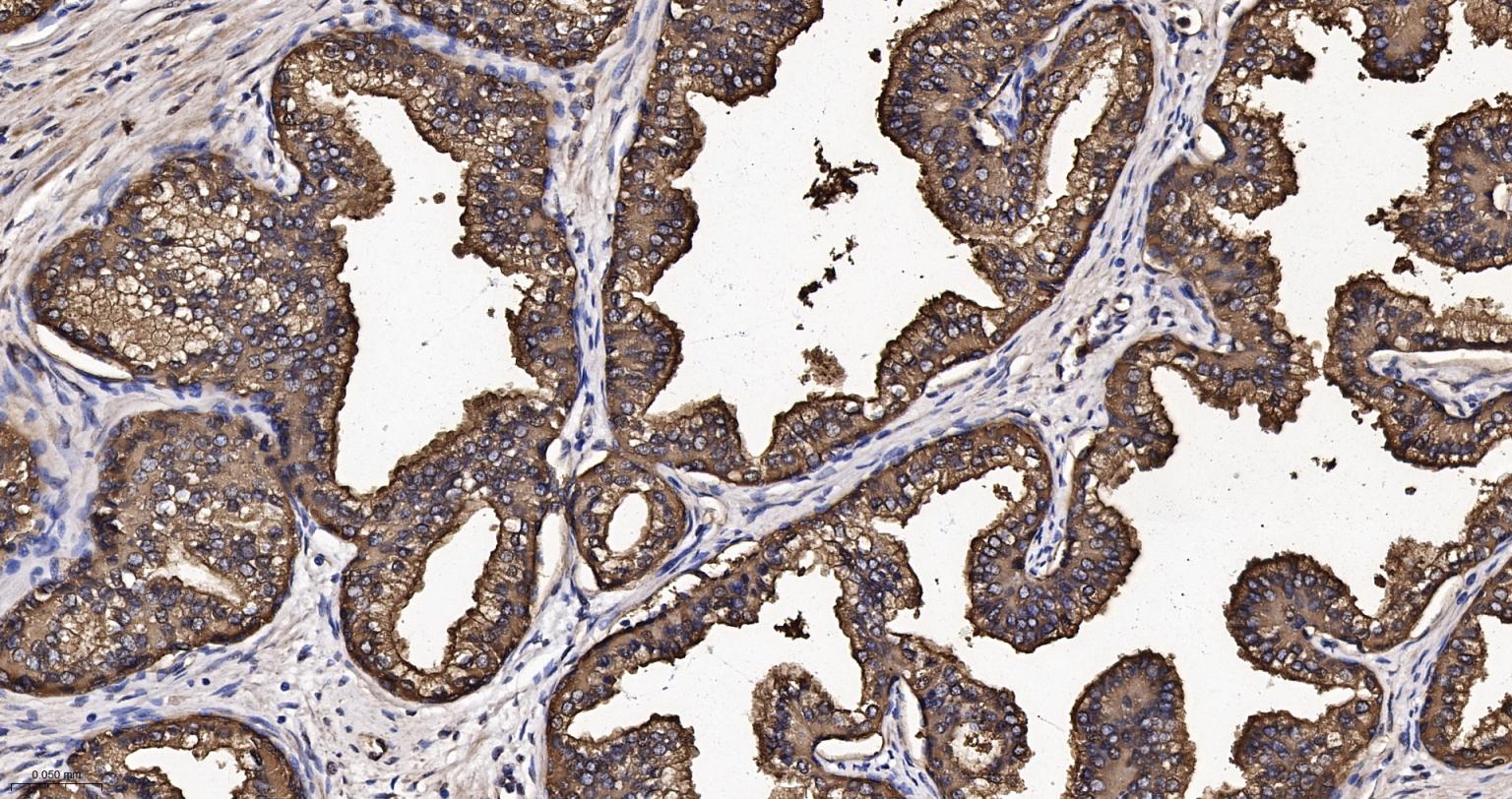 前列腺分泌蛋白重组兔单抗