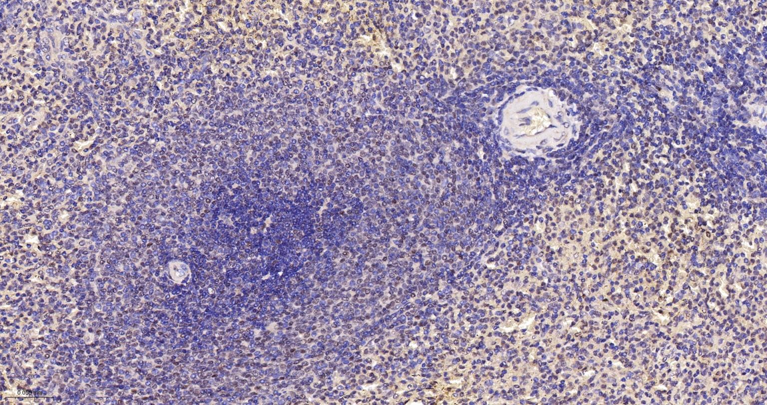端粒结合蛋白2重组兔单抗