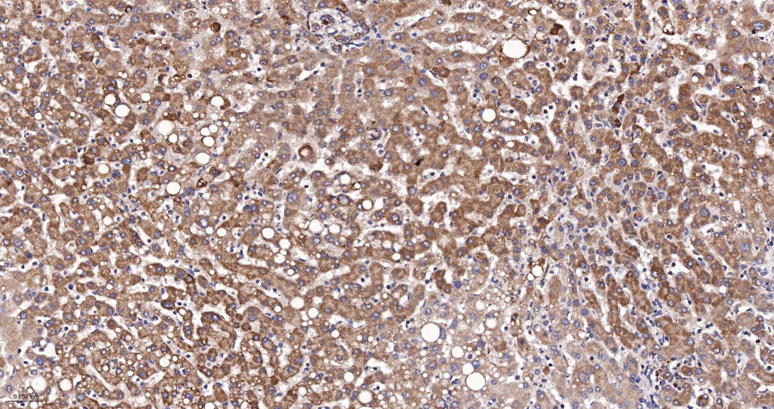 线粒体异柠檬酸脱氢酶重组兔单抗