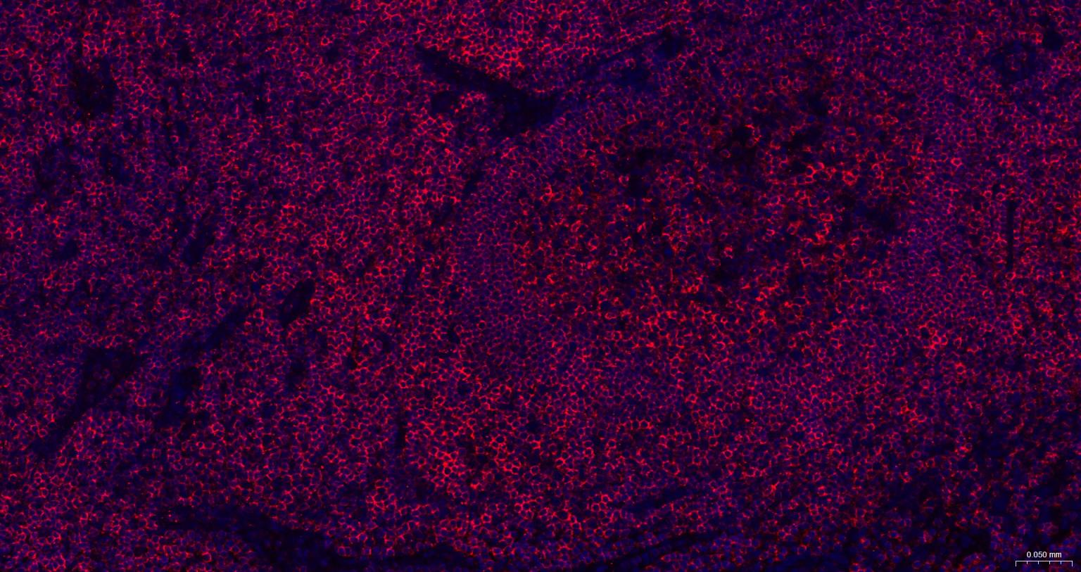 白细胞共同抗原CD45重组兔单抗