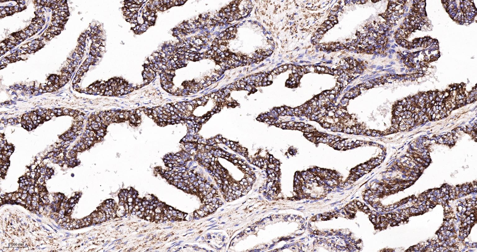 线粒体异柠檬酸脱氢酶重组兔单抗