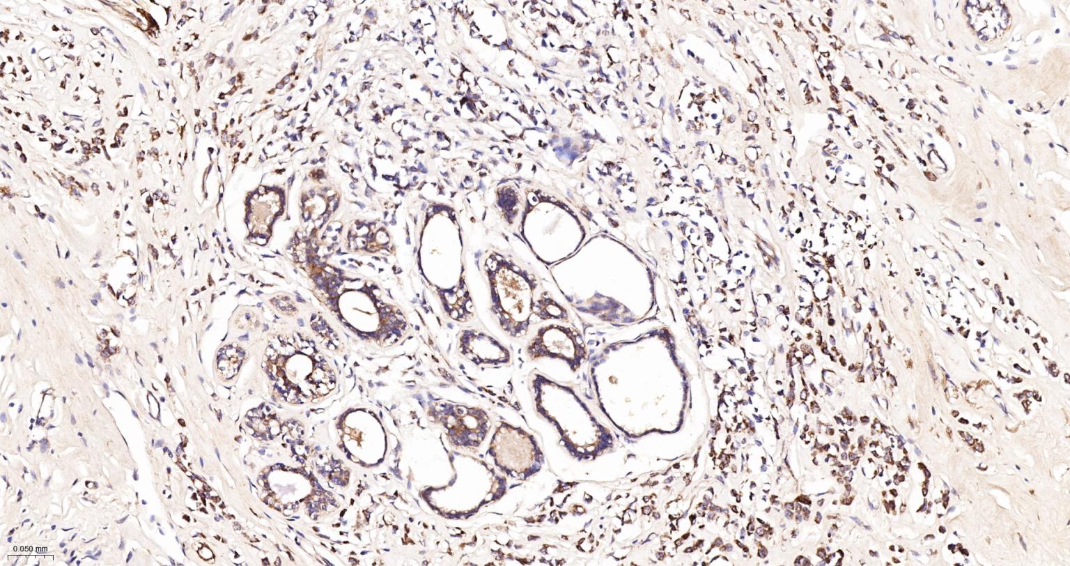 线粒体异柠檬酸脱氢酶重组兔单抗