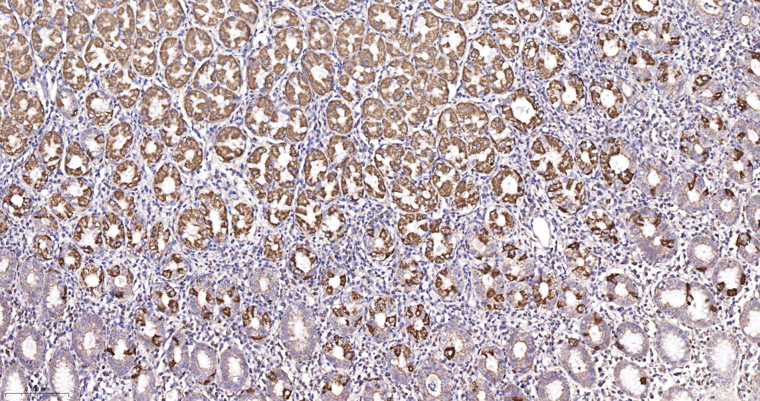 线粒体异柠檬酸脱氢酶重组兔单抗