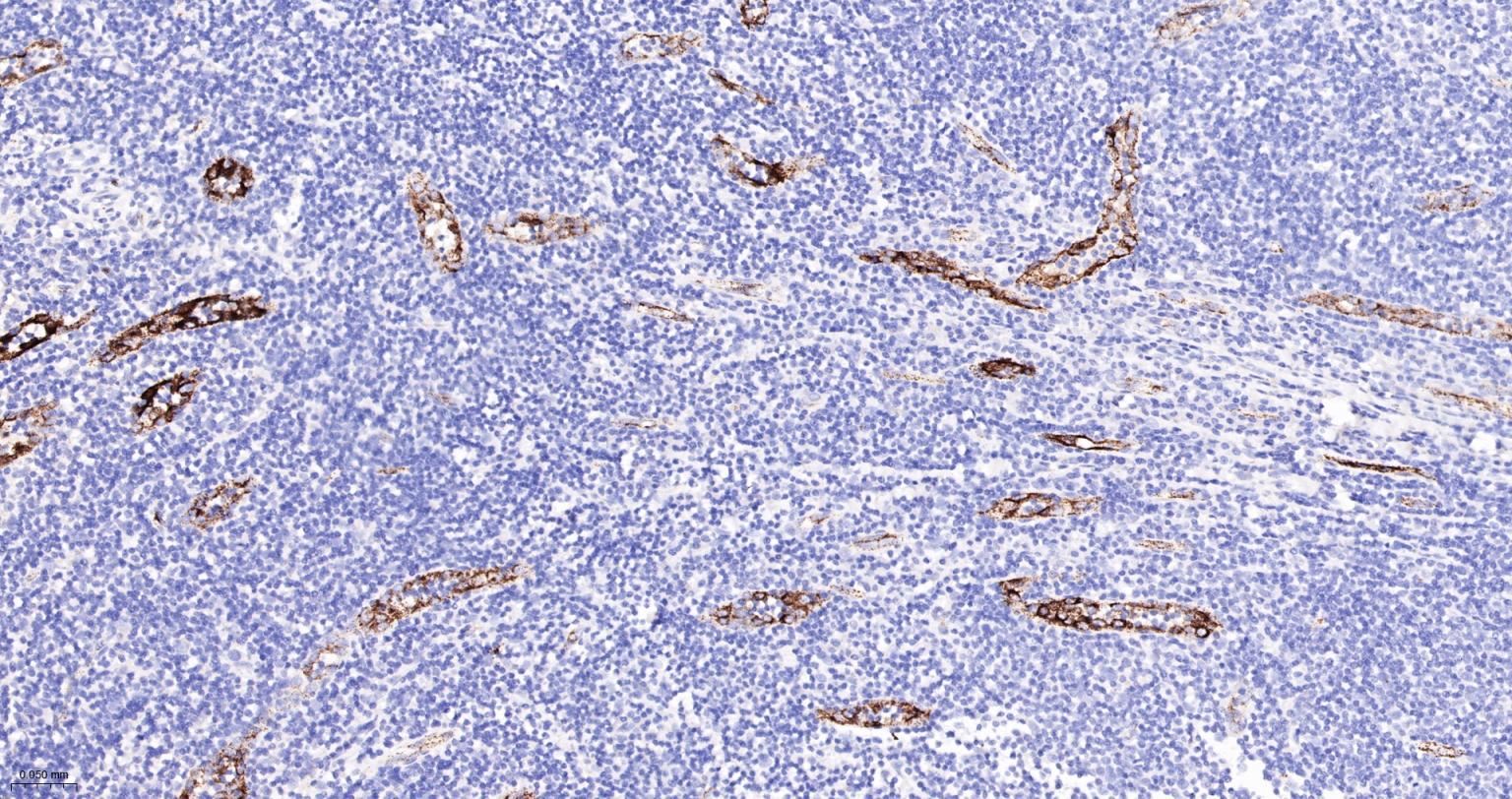 血管假性血友病因子重组兔单抗