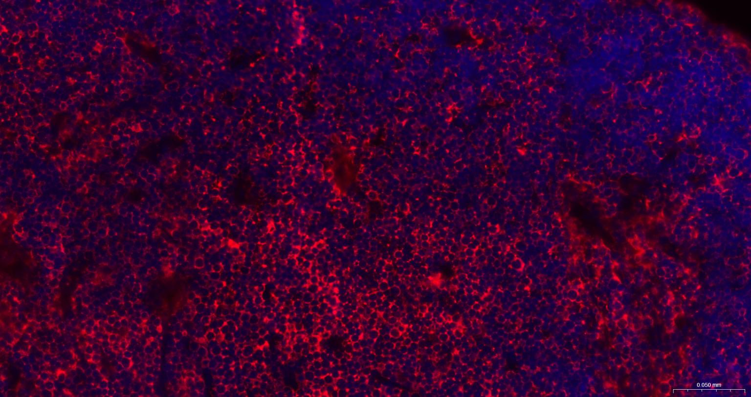 白血病相关蛋白18/癌蛋白18重组兔单抗