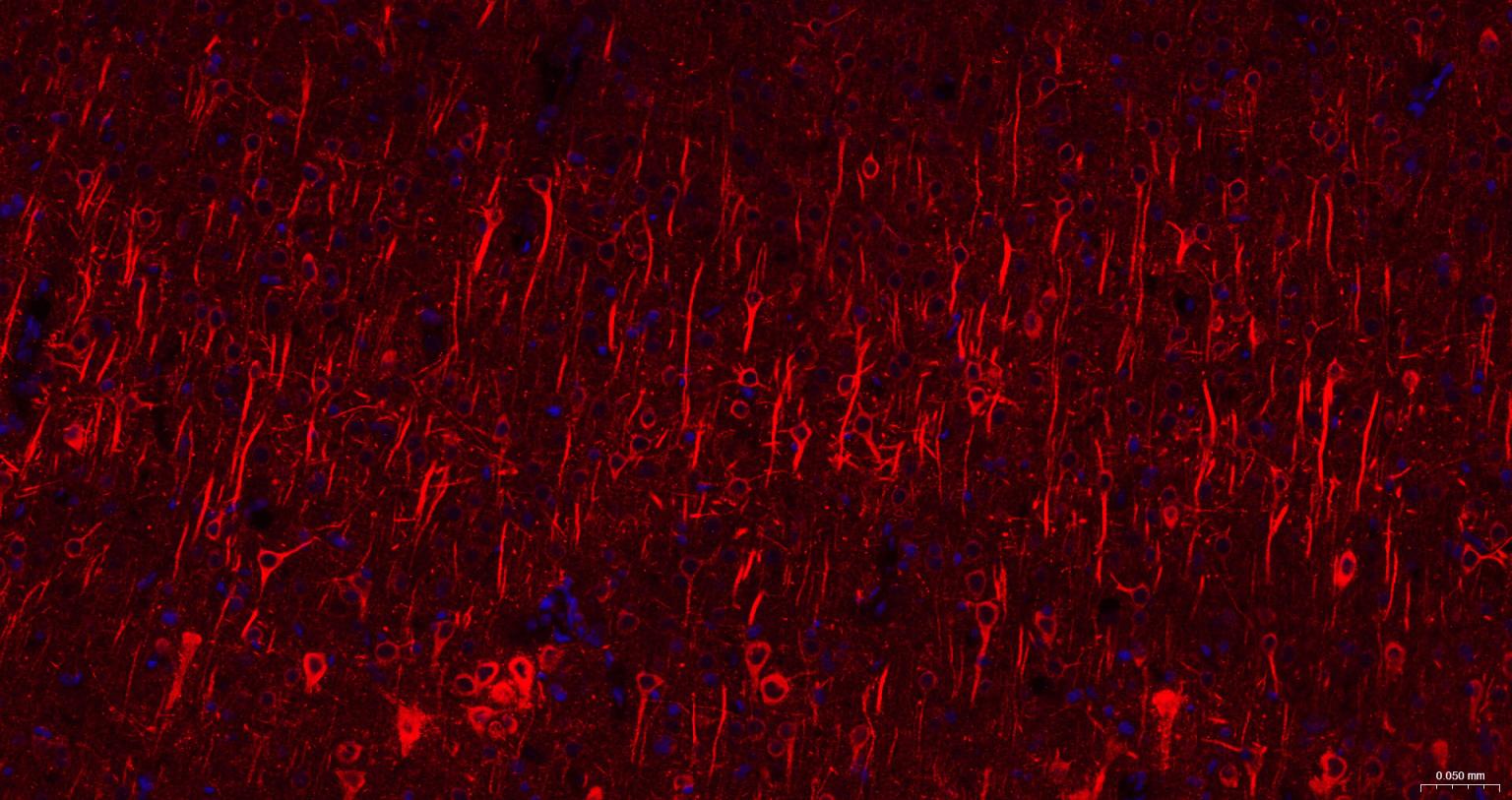 高分子量神经丝蛋白抗体