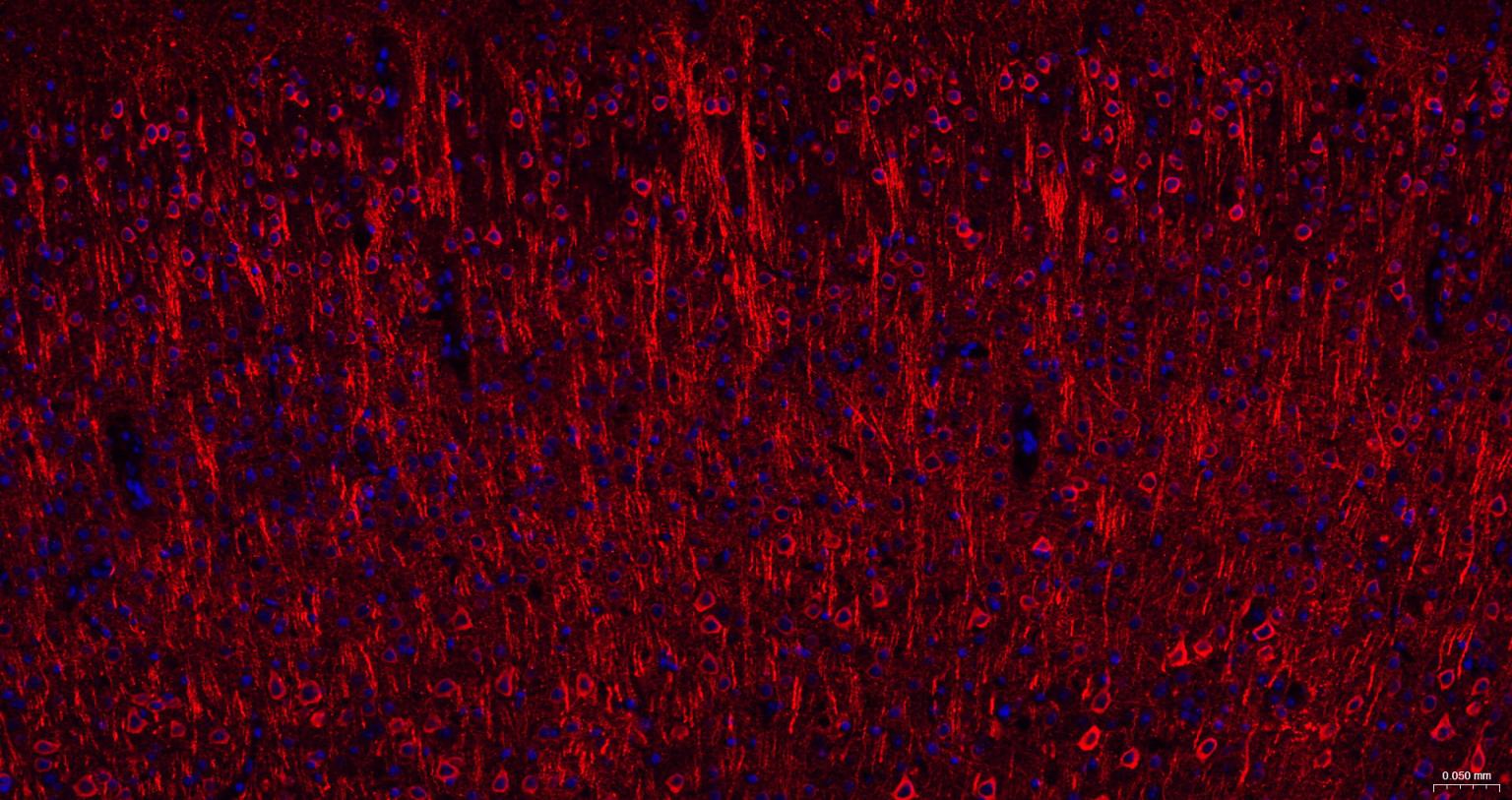 磷酸化微管相关蛋白2重组兔单抗-bsm-62863R