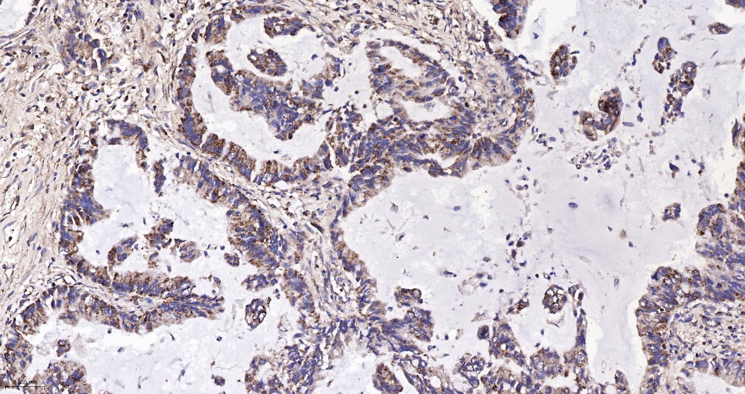 线粒体异柠檬酸脱氢酶重组兔单抗