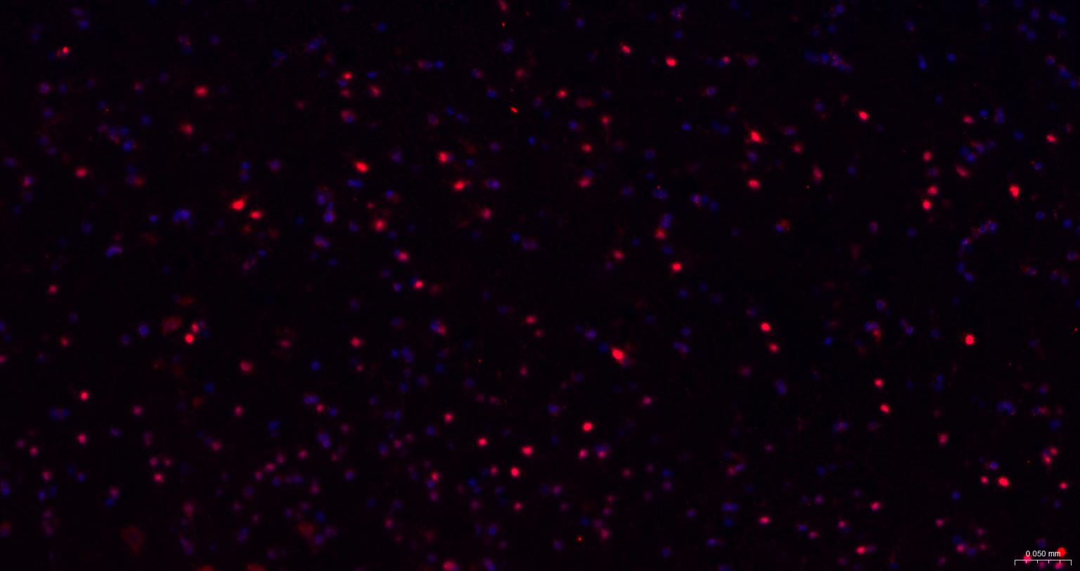 TBR1蛋白重组兔单抗