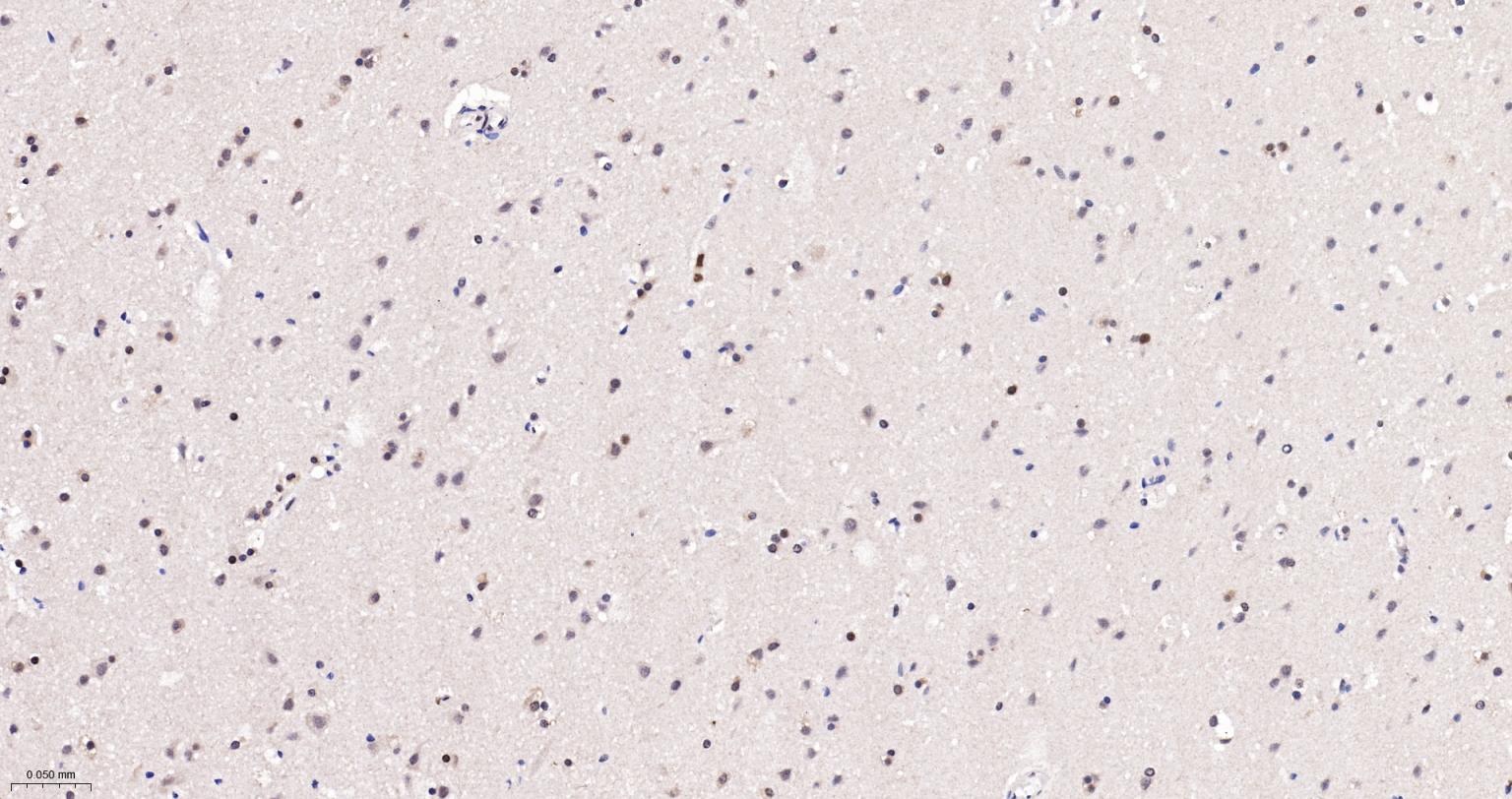 端粒结合蛋白2重组兔单抗