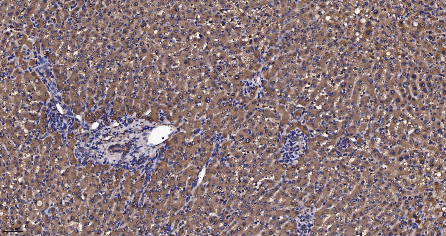 前列腺分泌蛋白重组兔单抗