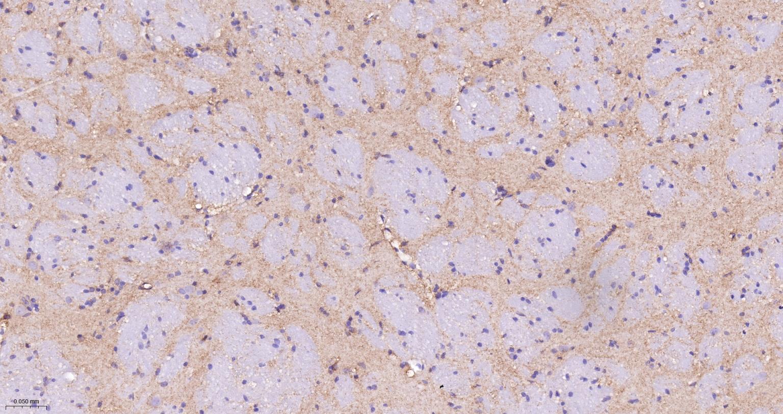 肌动蛋白相关蛋白2重组兔单抗