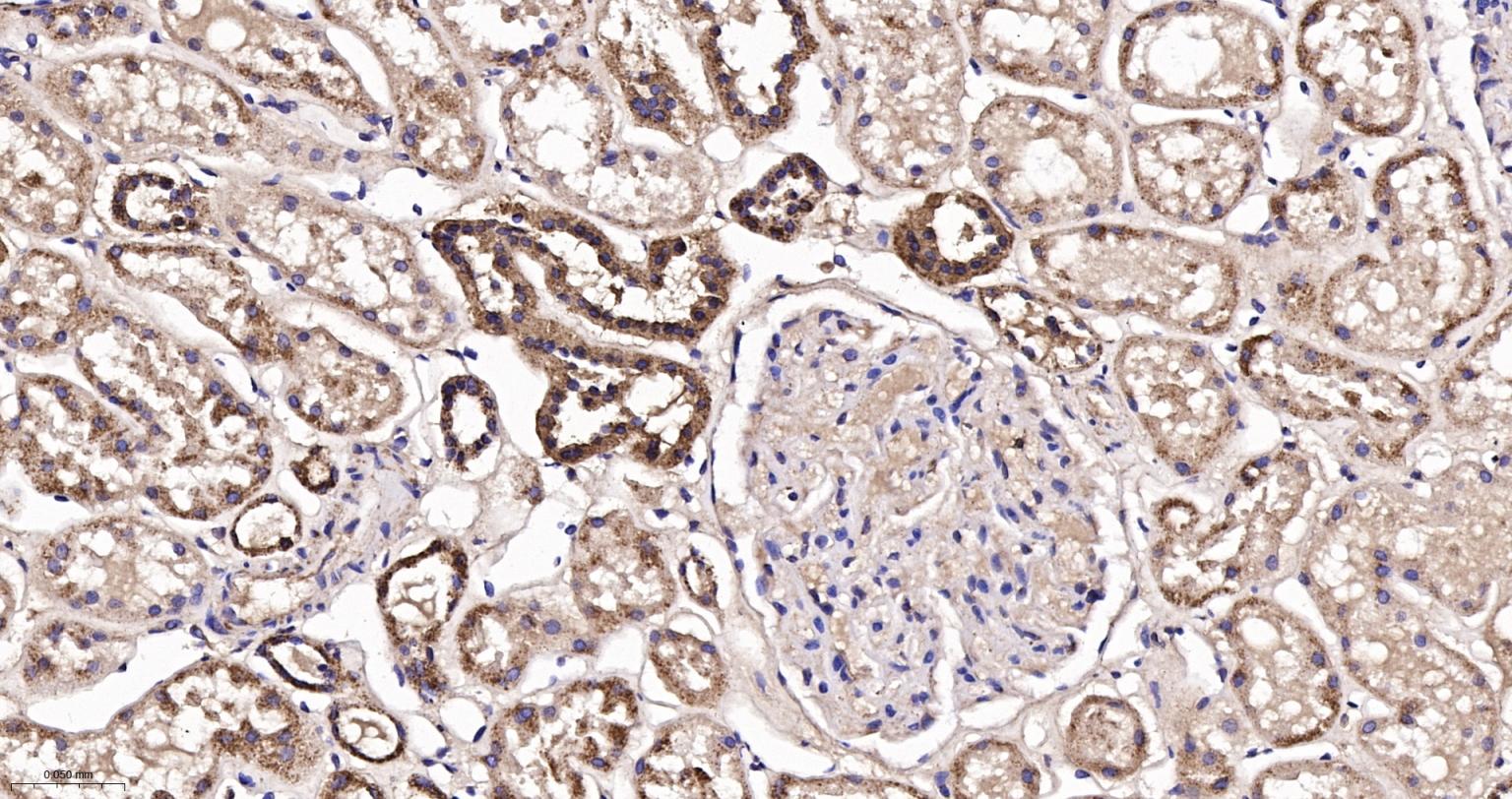 线粒体异柠檬酸脱氢酶重组兔单抗