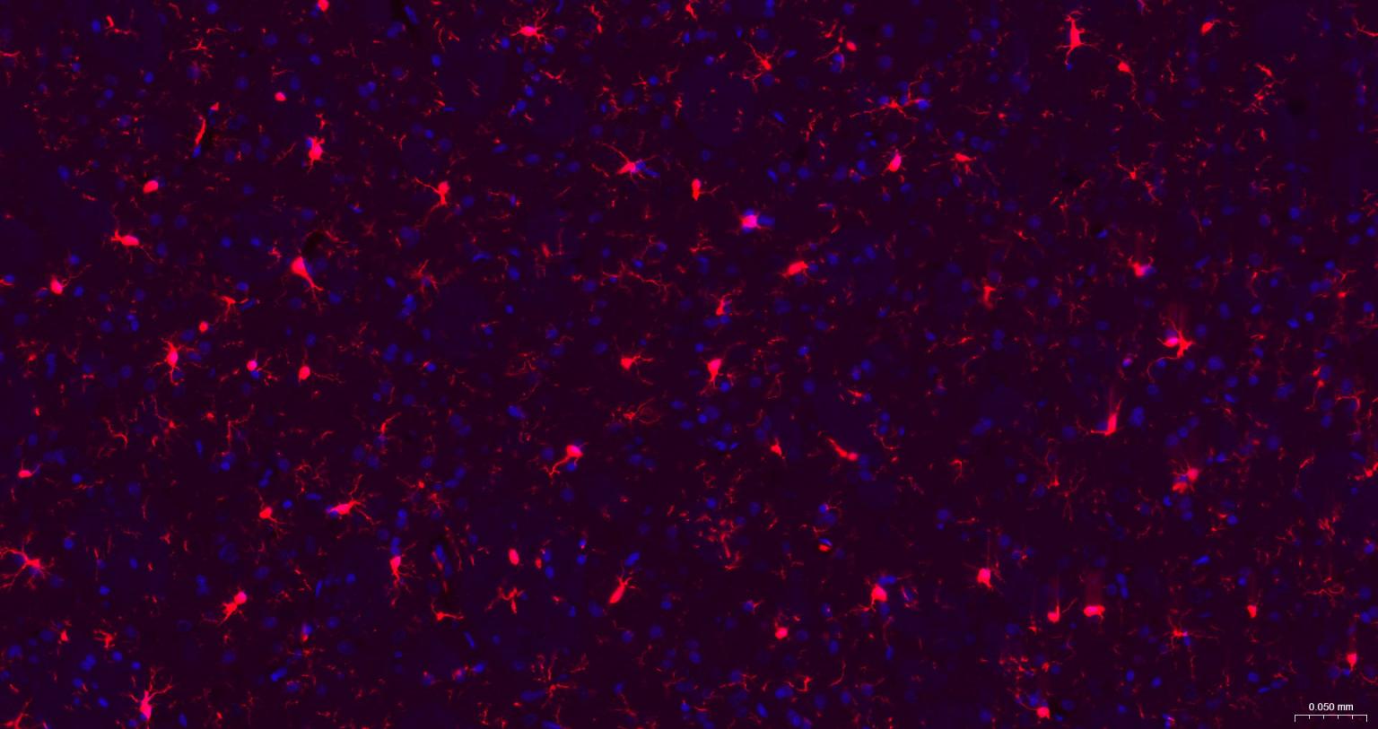 离子钙接头蛋白单克隆抗体-bsm-54132R
