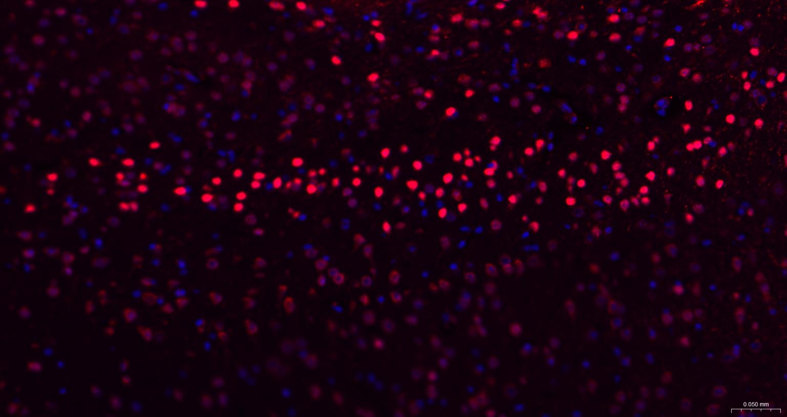 TBR1蛋白重组兔单抗