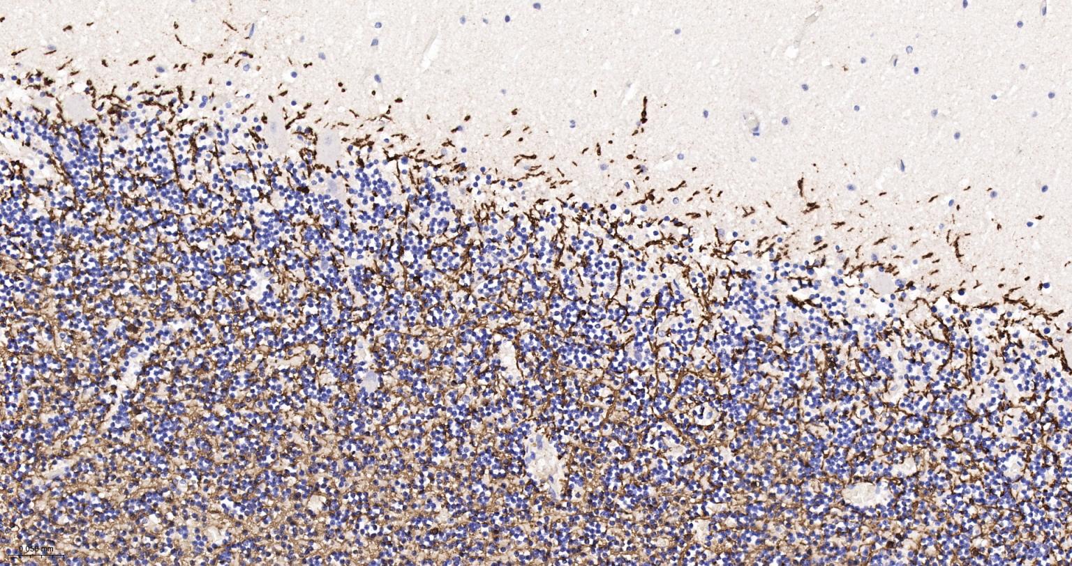 髓鞘碱性蛋白/磷脂碱性蛋白重组兔单抗