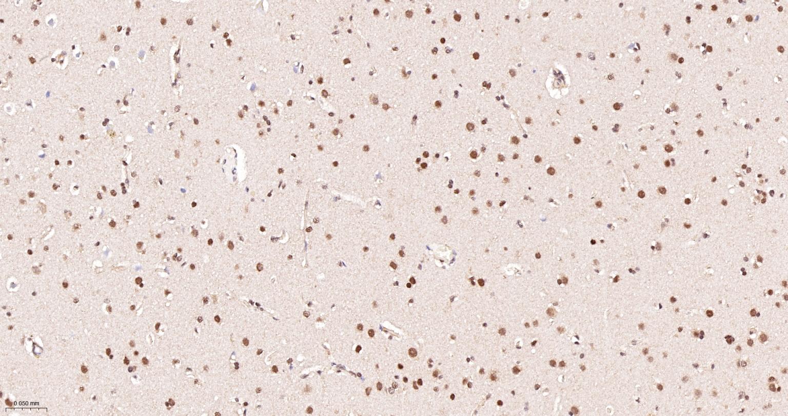 端粒结合蛋白2重组兔单抗