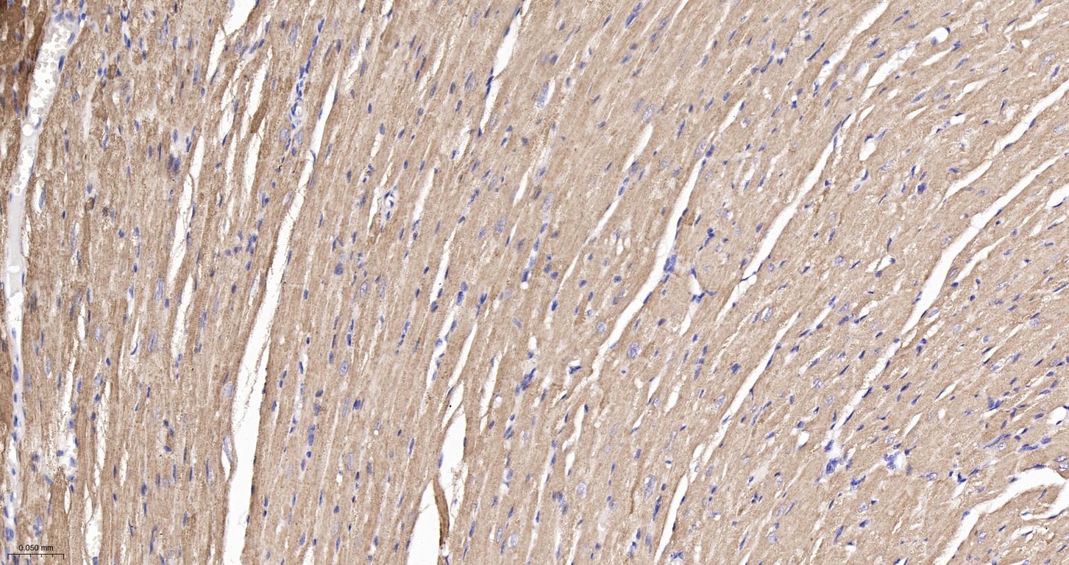 线粒体异柠檬酸脱氢酶重组兔单抗