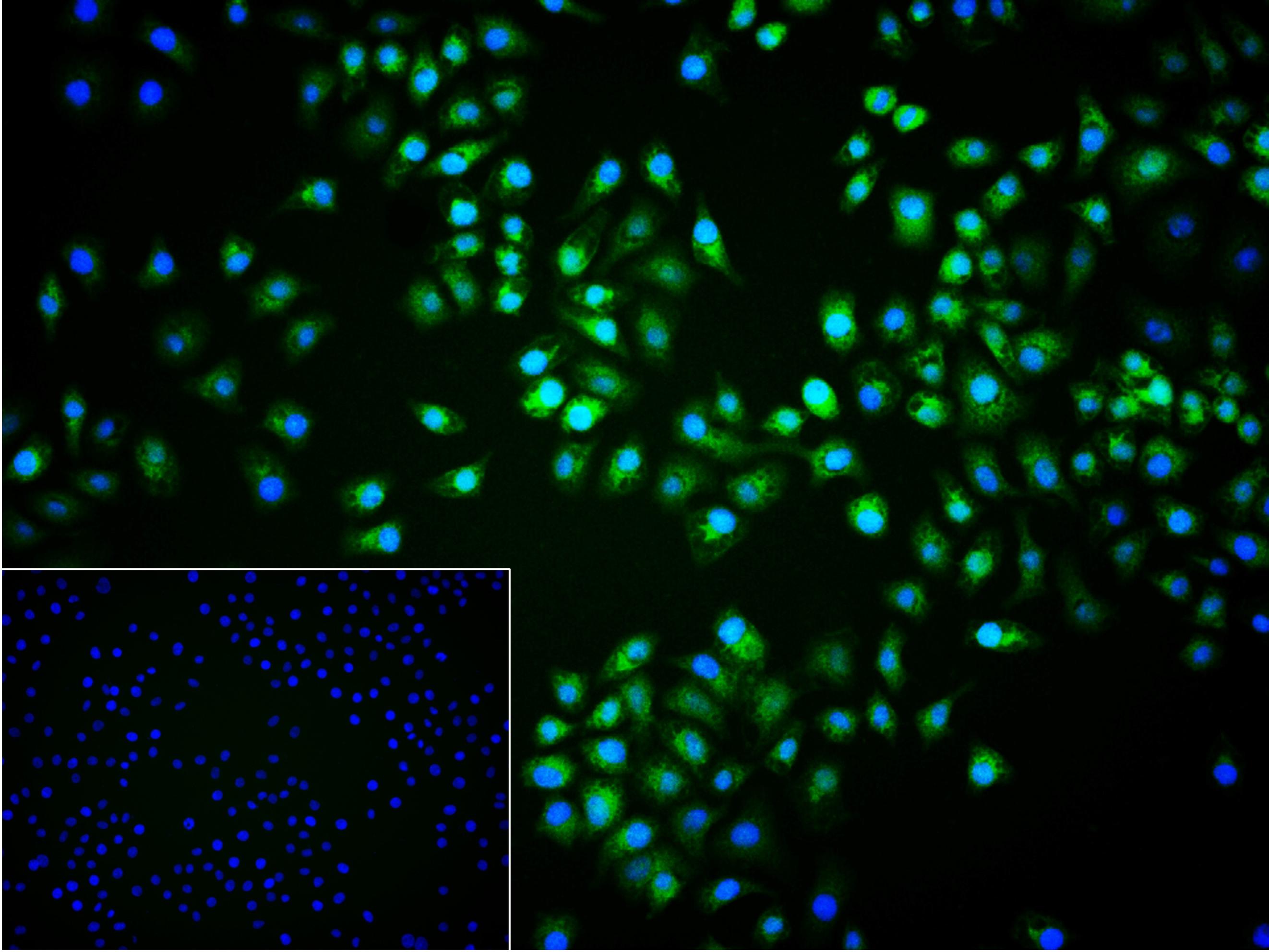 异质核糖核蛋白Q重组兔单抗