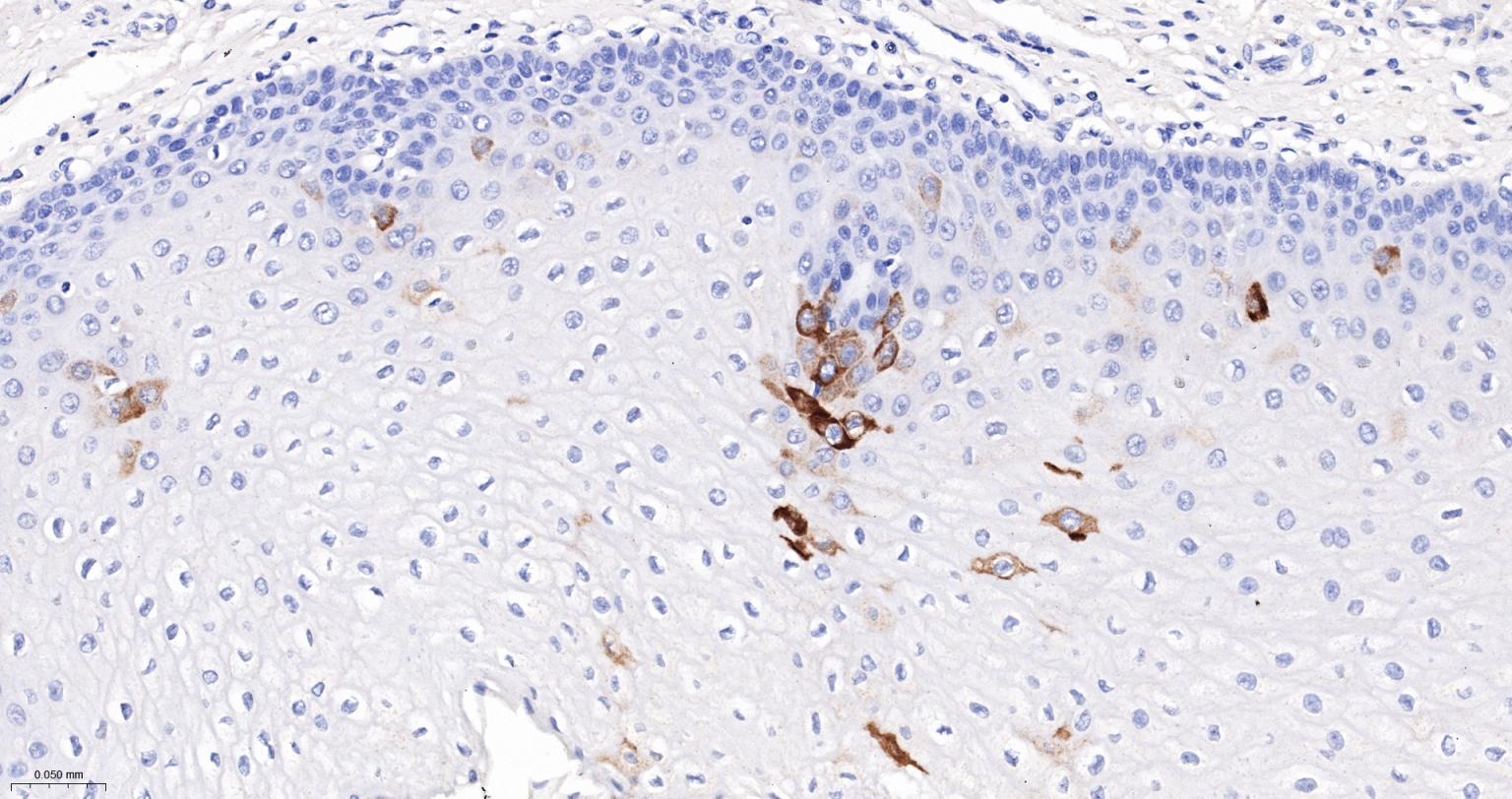 细胞角蛋白10重组兔单抗