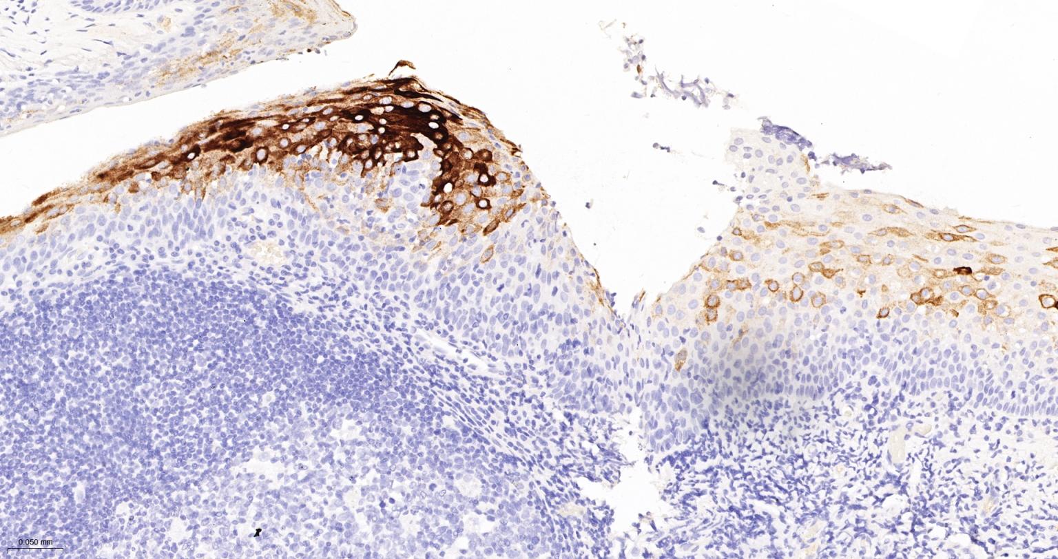 细胞角蛋白10重组兔单抗