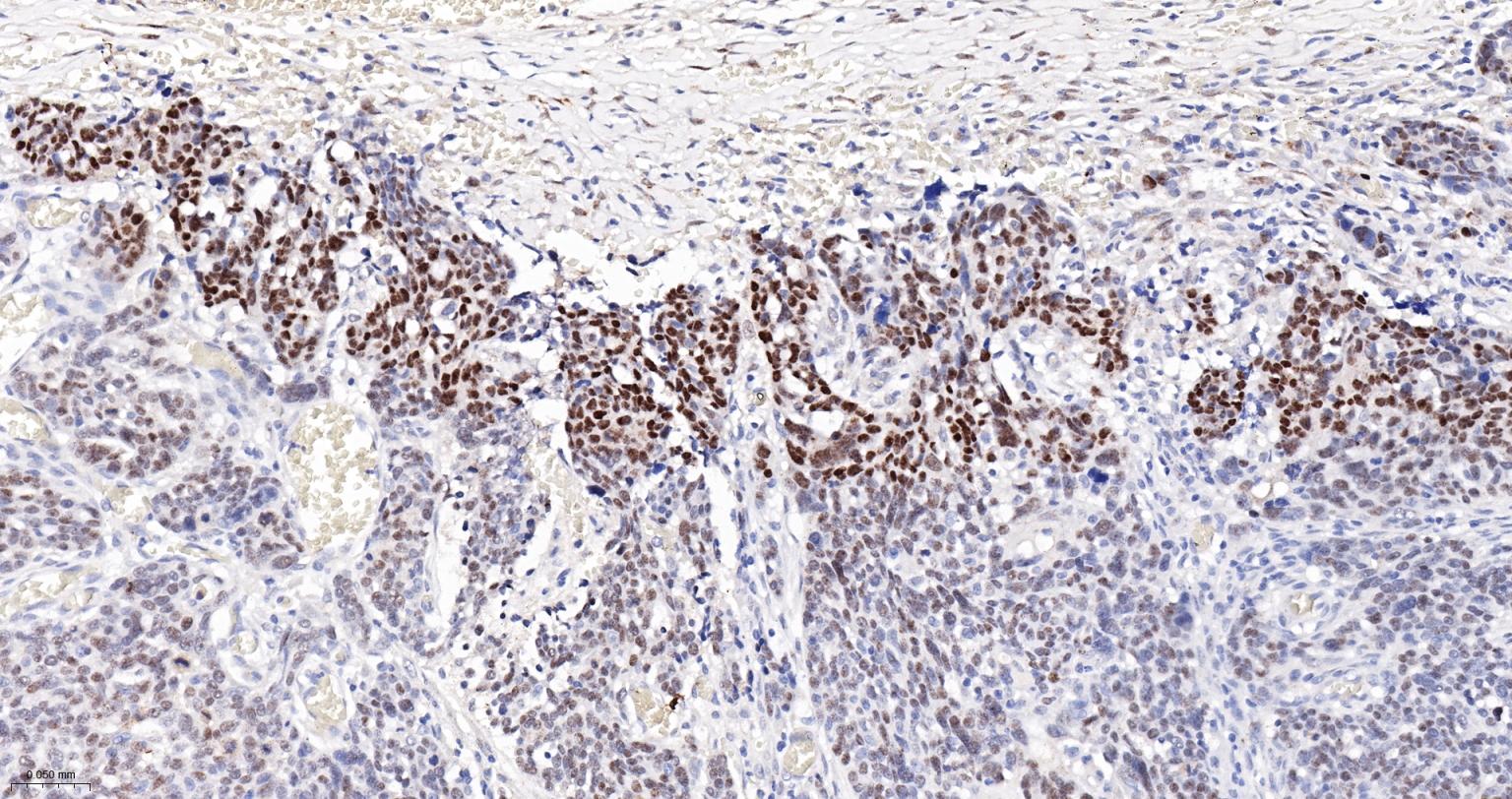 肾母细胞瘤蛋白重组兔单抗