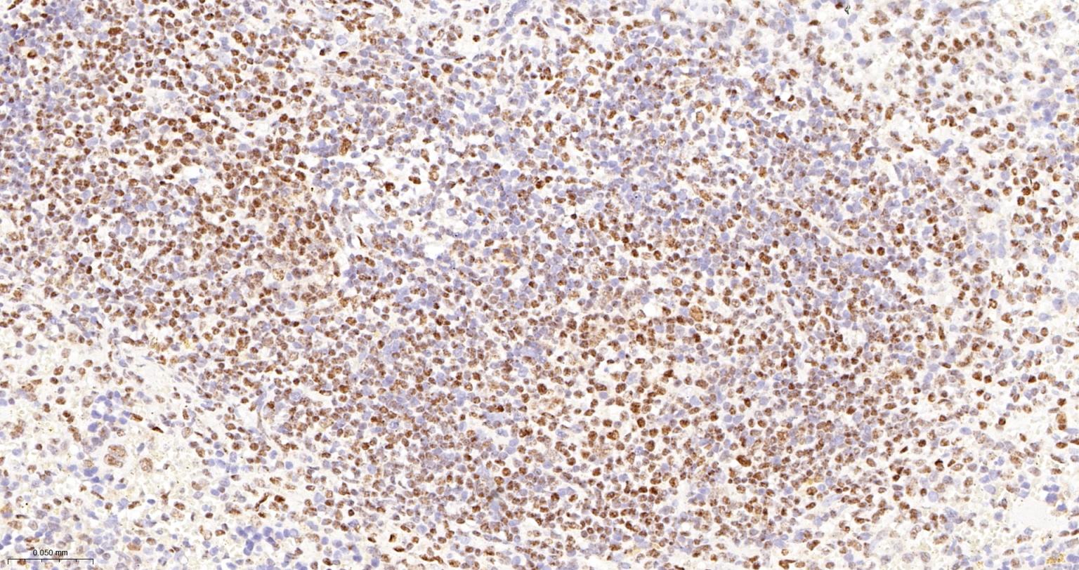 DNA解旋酶V重组兔单抗-bsm-60625R