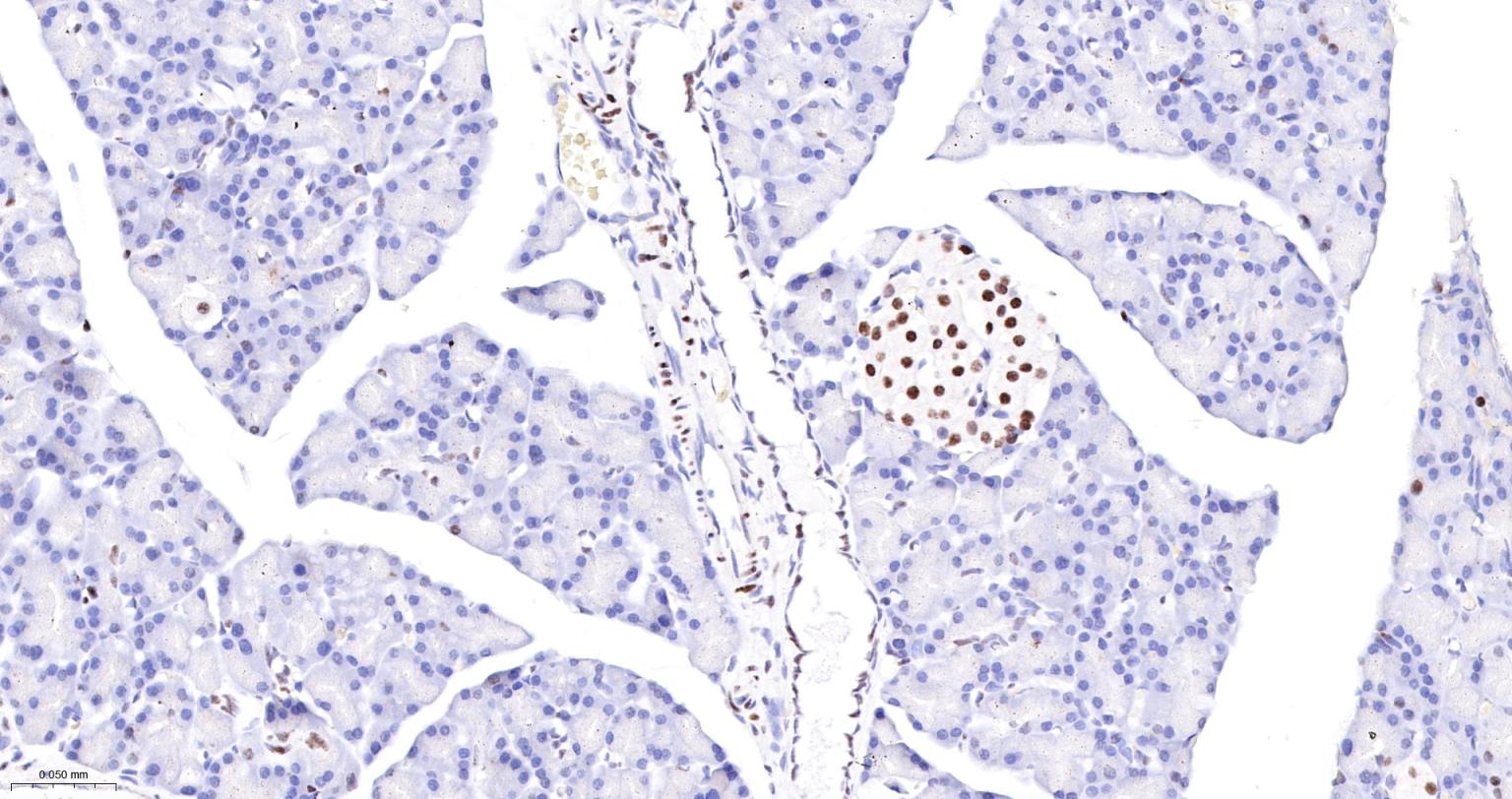 DNA解旋酶V重组兔单抗-bsm-60625R