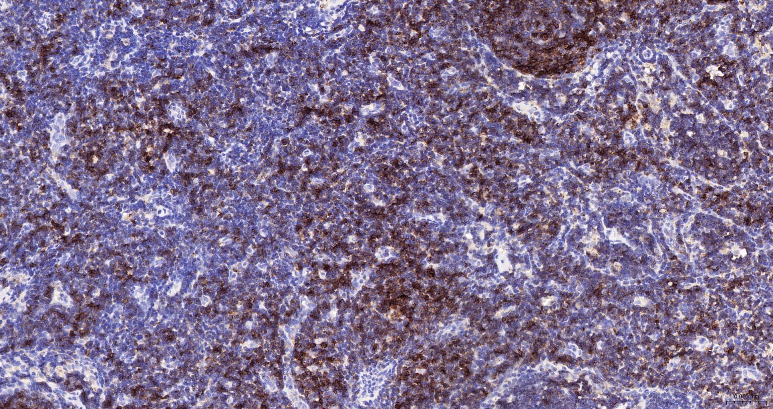 HRP标记的白细胞共同抗原CD45重组兔单抗-bsm-54757R-HRP