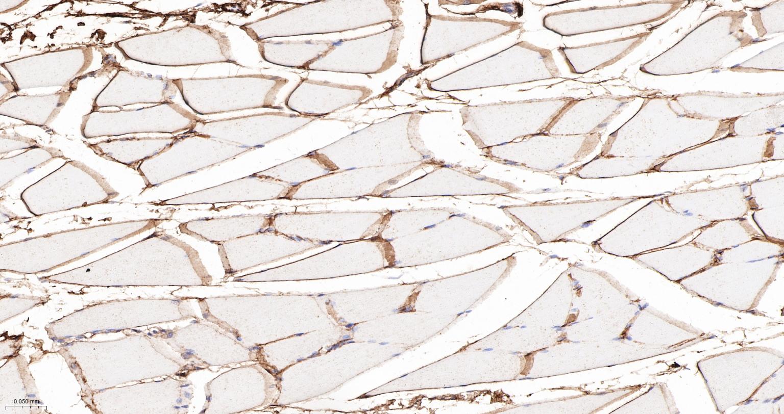 6型胶原重组兔单抗