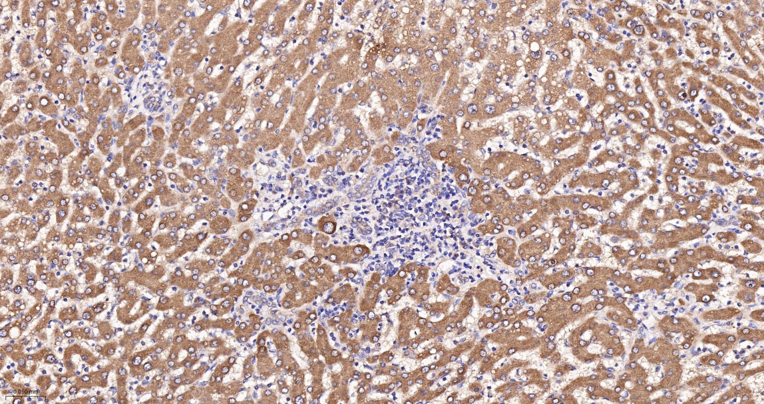 精氨酸tRNA的蛋白转移酶1重组兔单抗-bsm-62759R