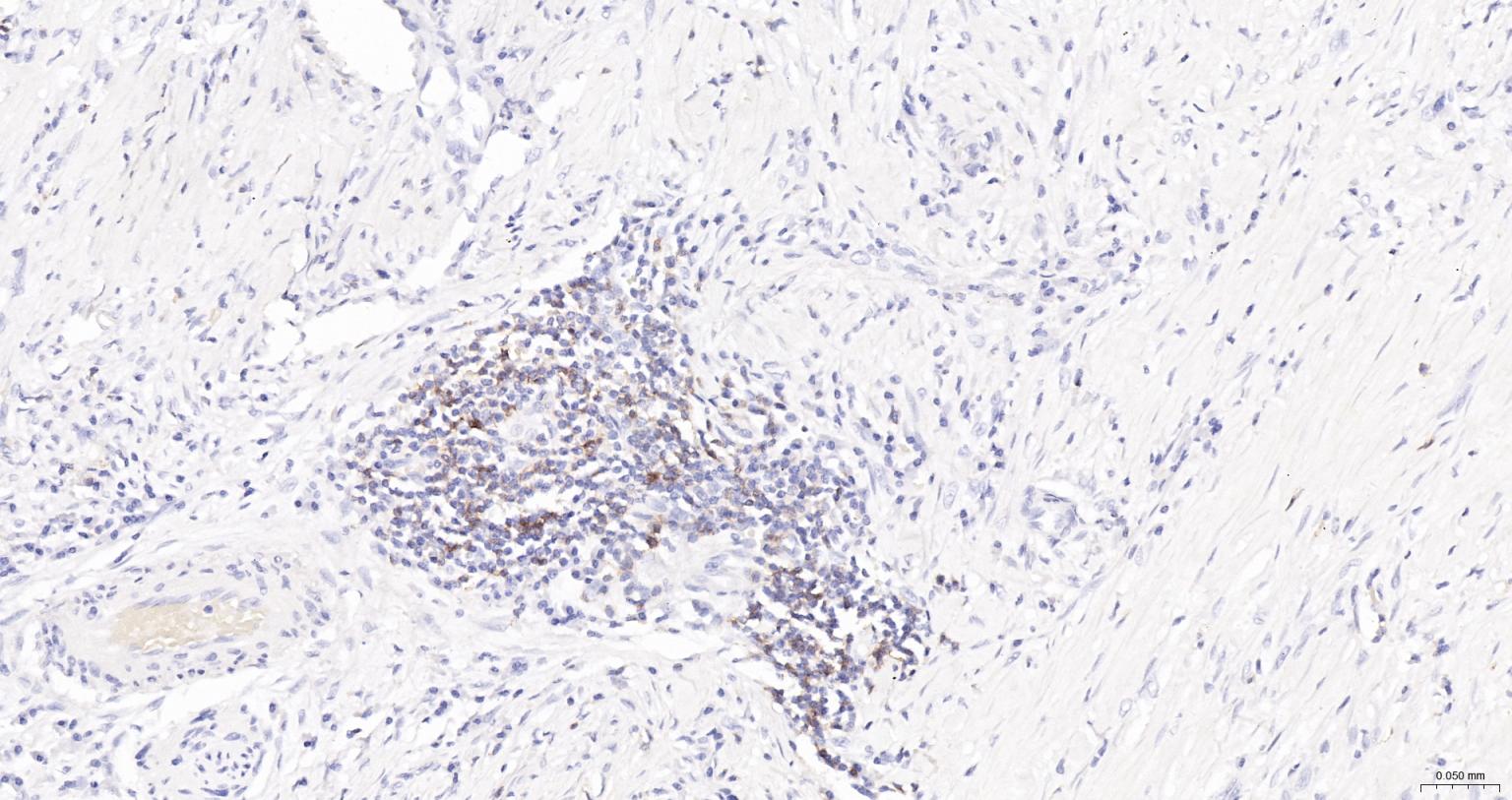 HRP标记的白细胞共同抗原CD45重组兔单抗-bsm-54757R-HRP