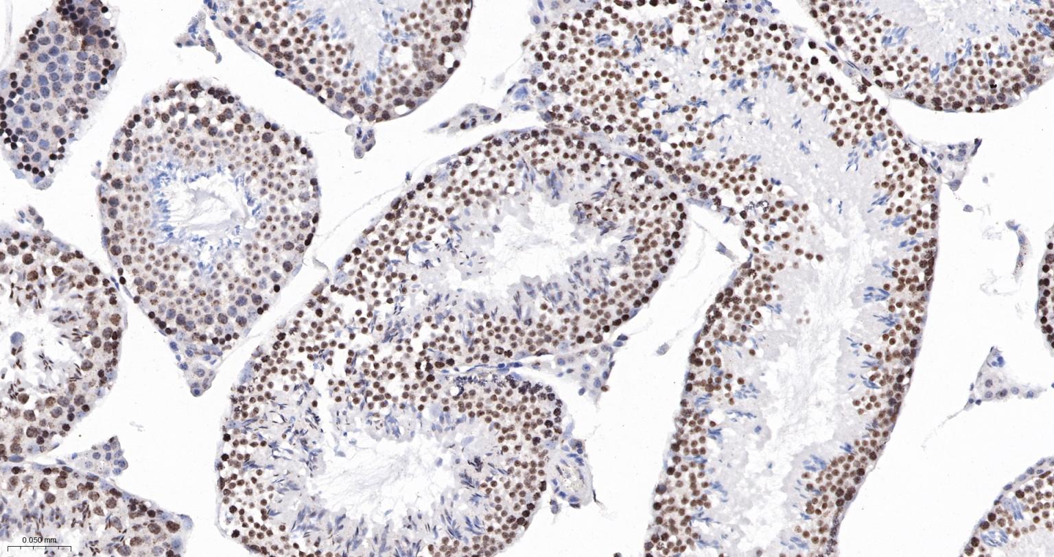 高迁移率族蛋白A1重组兔单抗