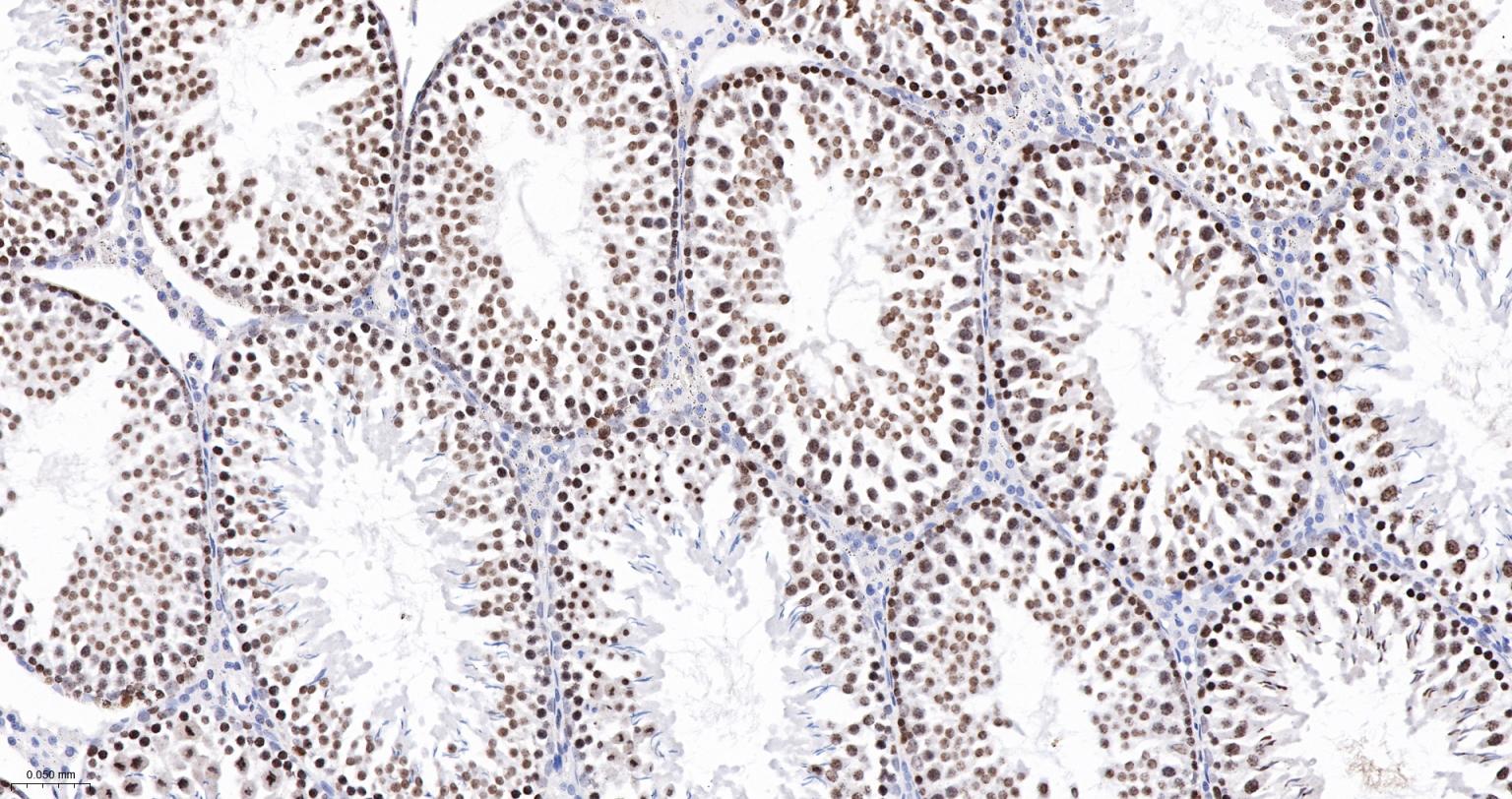 高迁移率族蛋白A1重组兔单抗