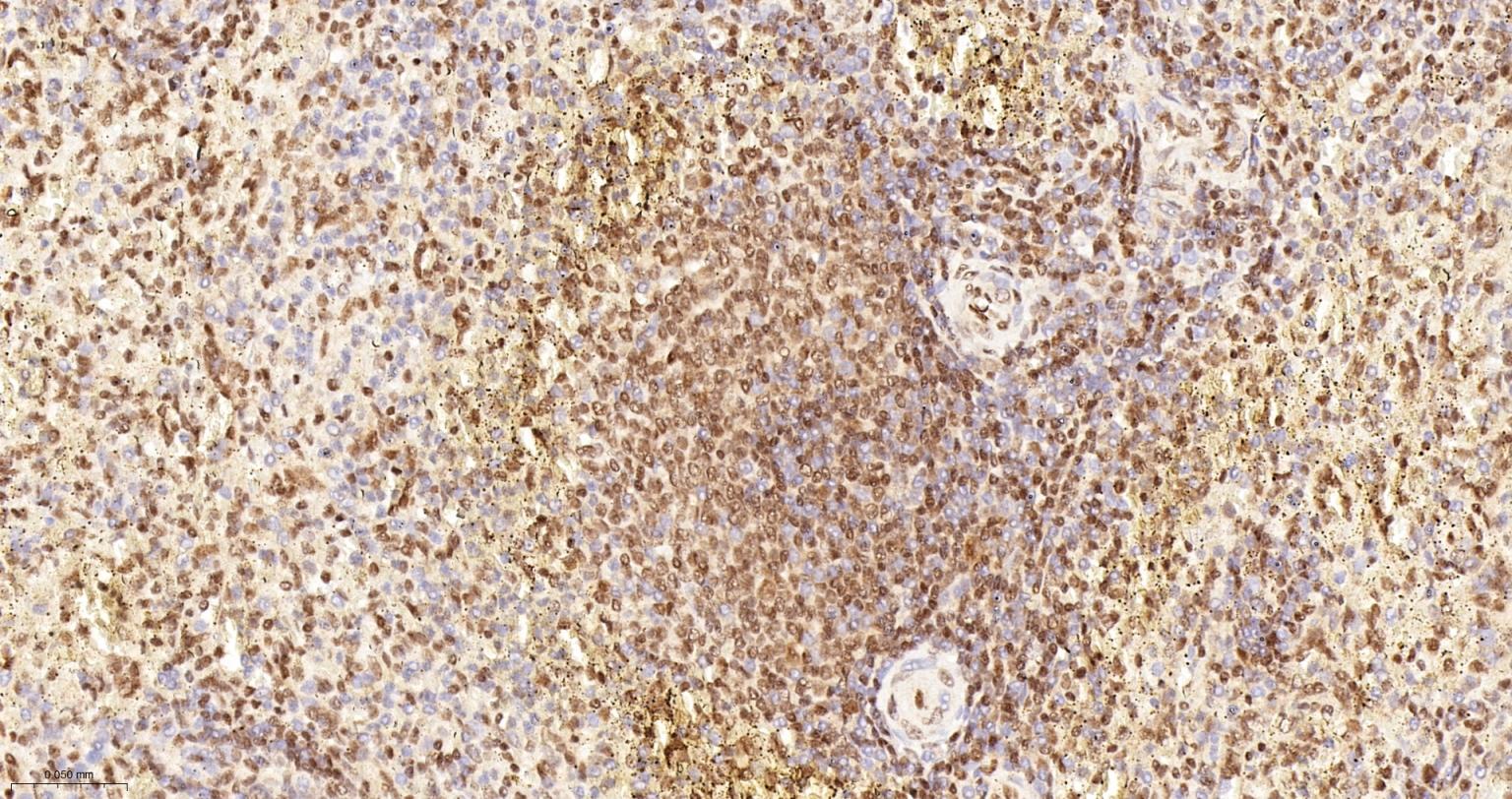 DNA解旋酶V重组兔单抗-bsm-60625R