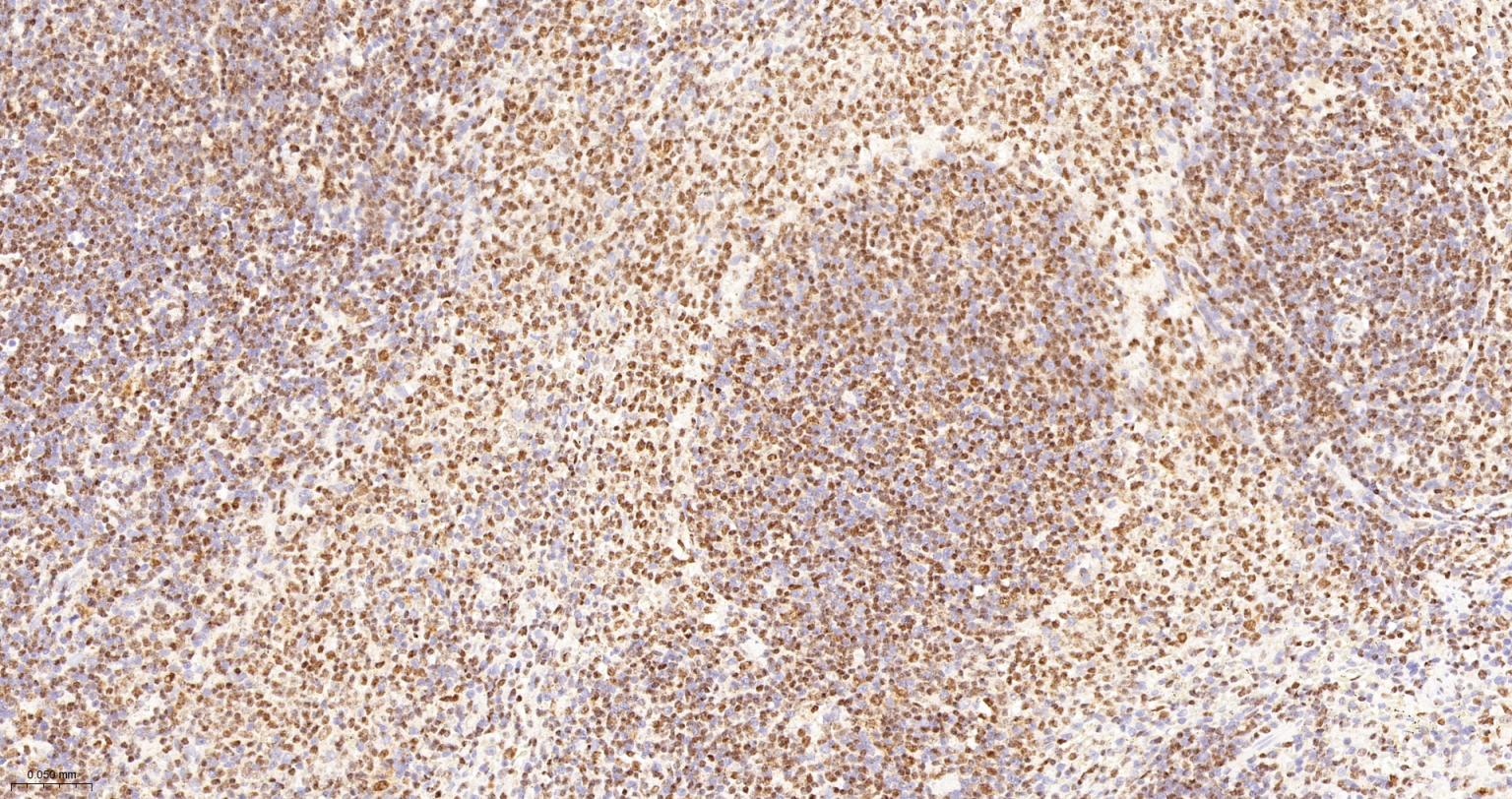 DNA解旋酶V重组兔单抗-bsm-60625R