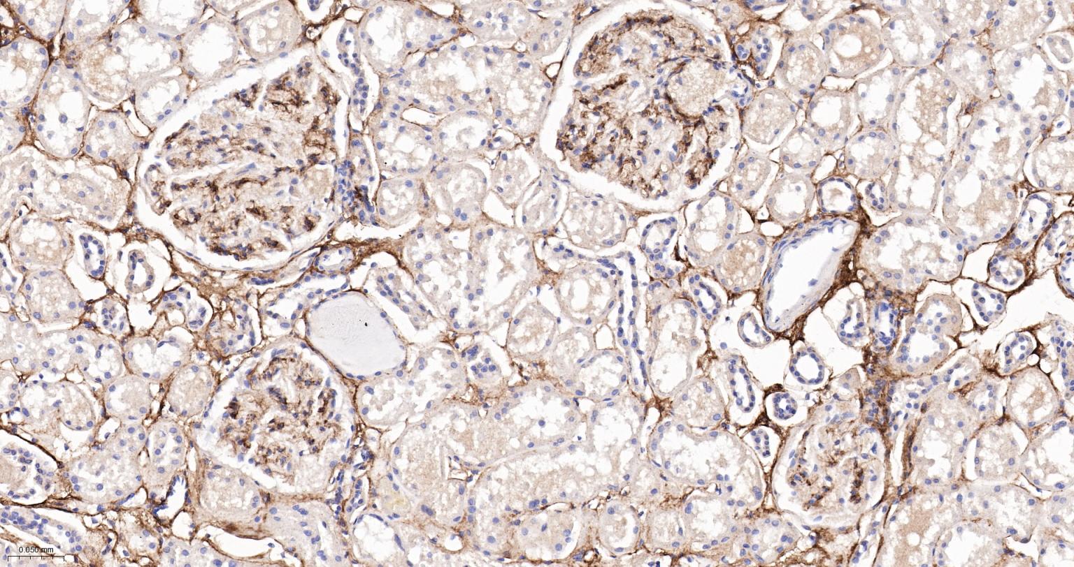 6型胶原重组兔单抗