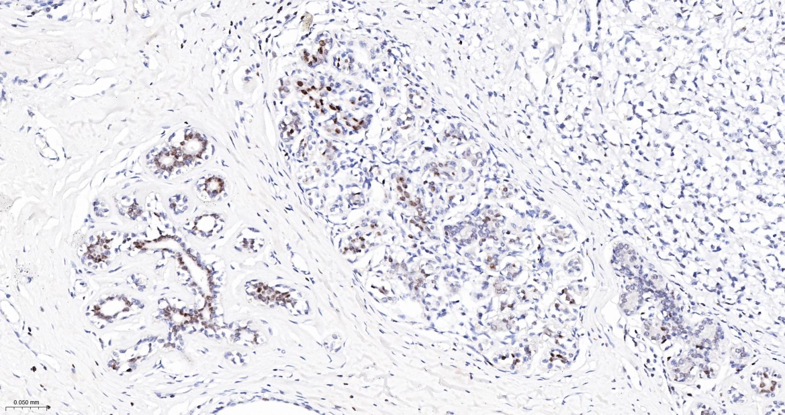 高迁移率族蛋白A1重组兔单抗